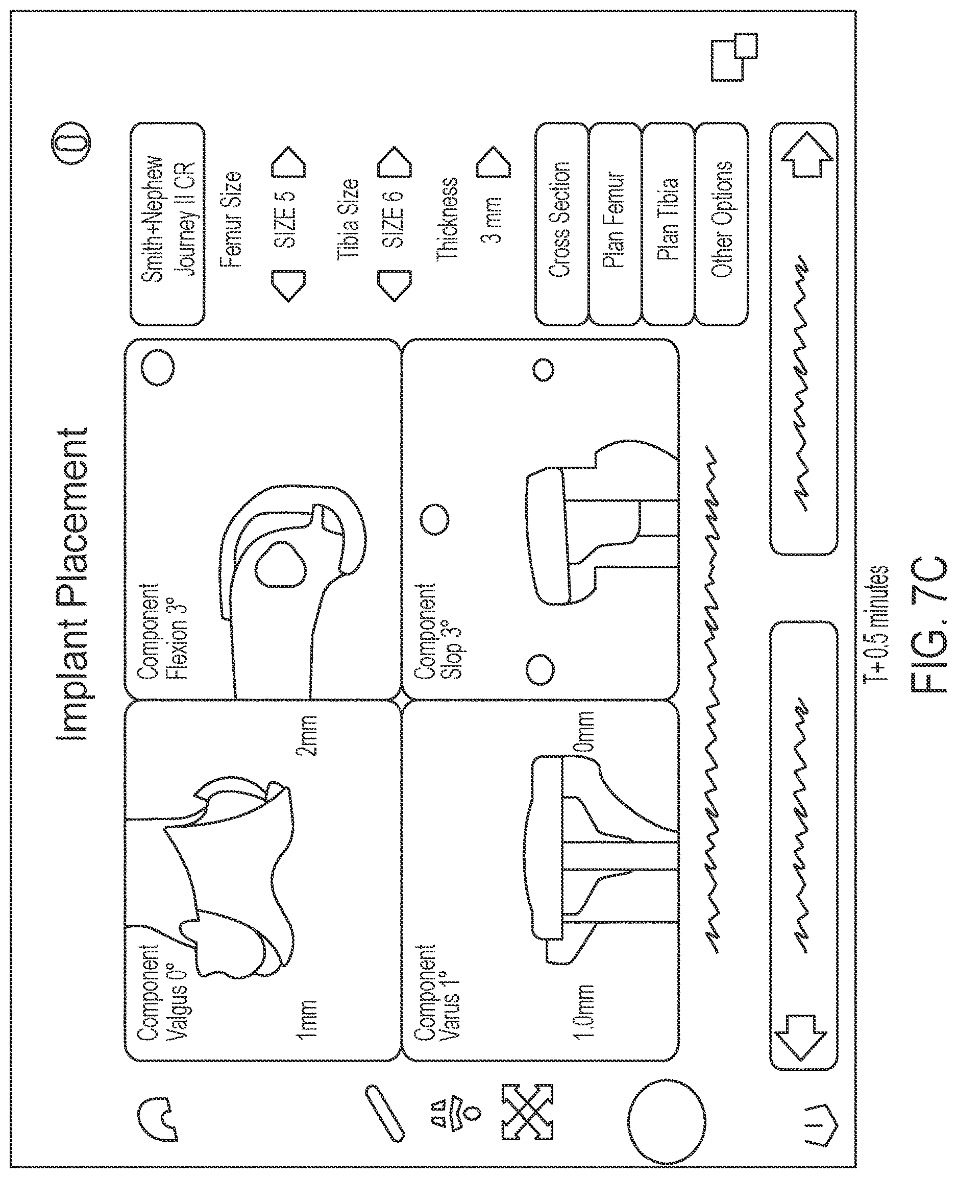 Patent US12616521 Figure 11 – Intraoperative visualization and manipulation of CAD objects