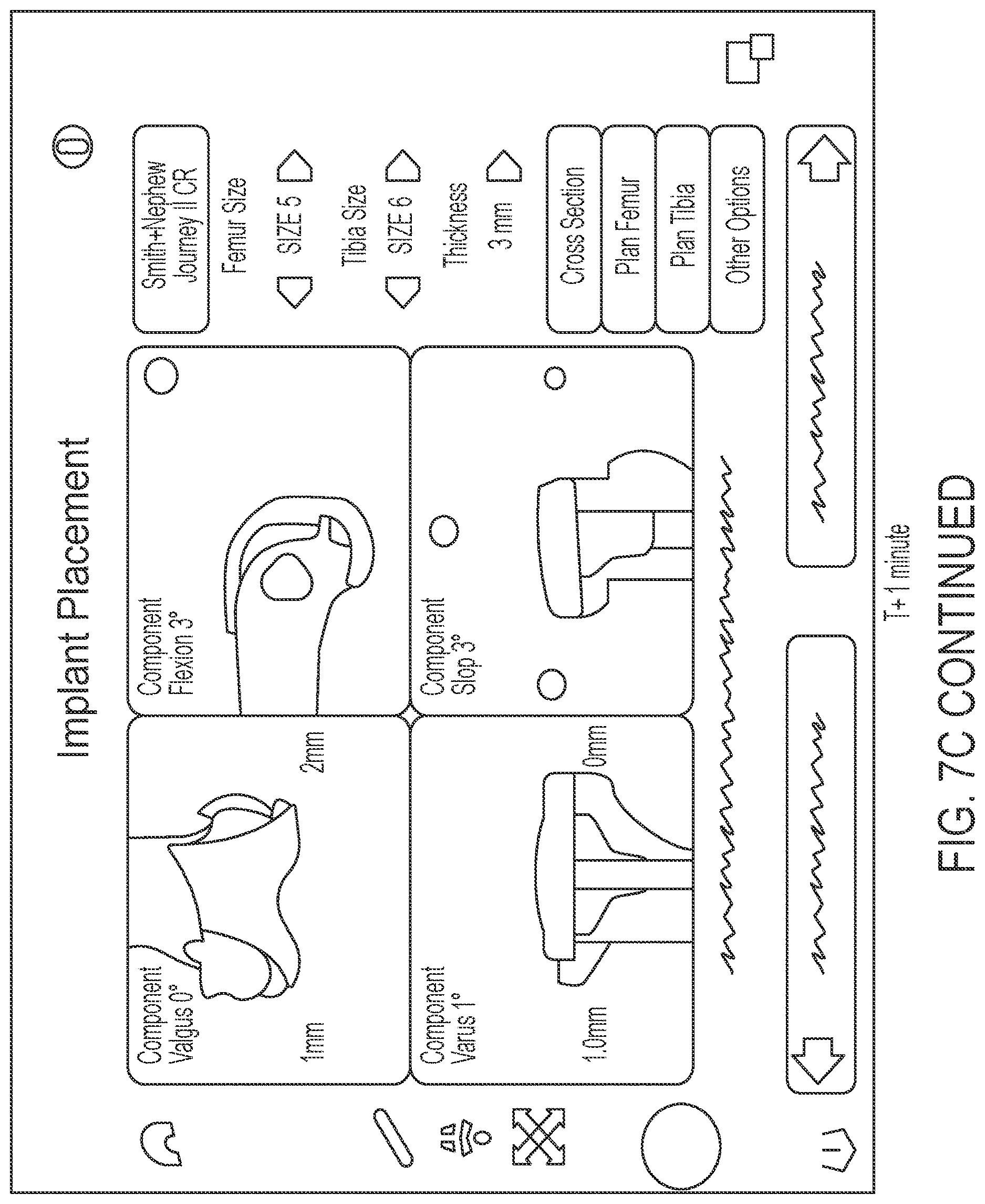 Patent US12616521 Figure 12 – Intraoperative visualization and manipulation of CAD objects