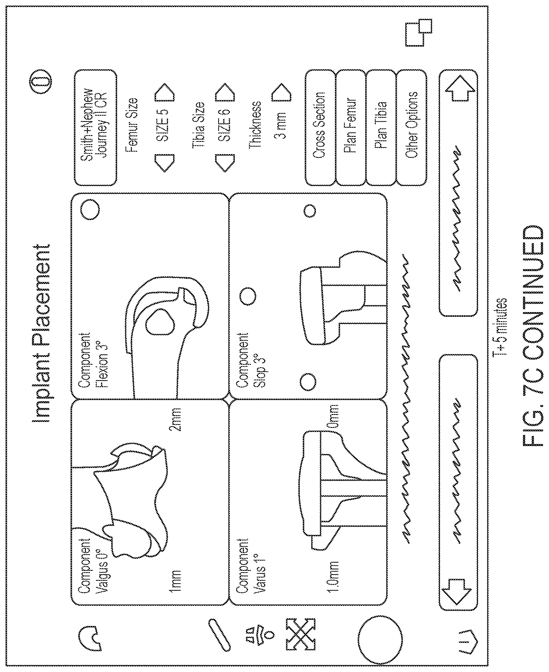 Patent US12616521 Figure 13 – Intraoperative visualization and manipulation of CAD objects