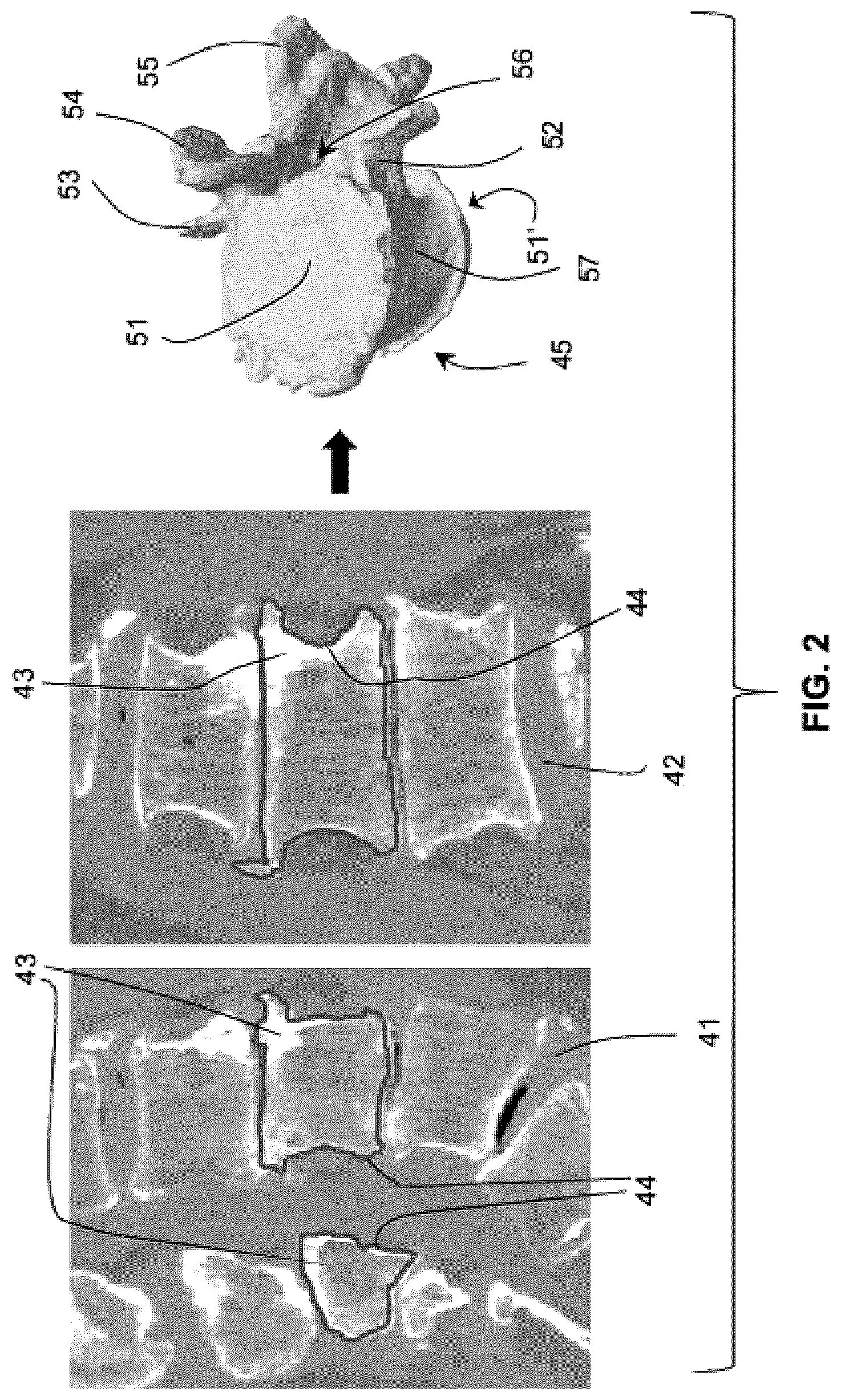 Patent US12616522 Figure 2 – Method for determining the screw trajectory of a pedicle bone screw