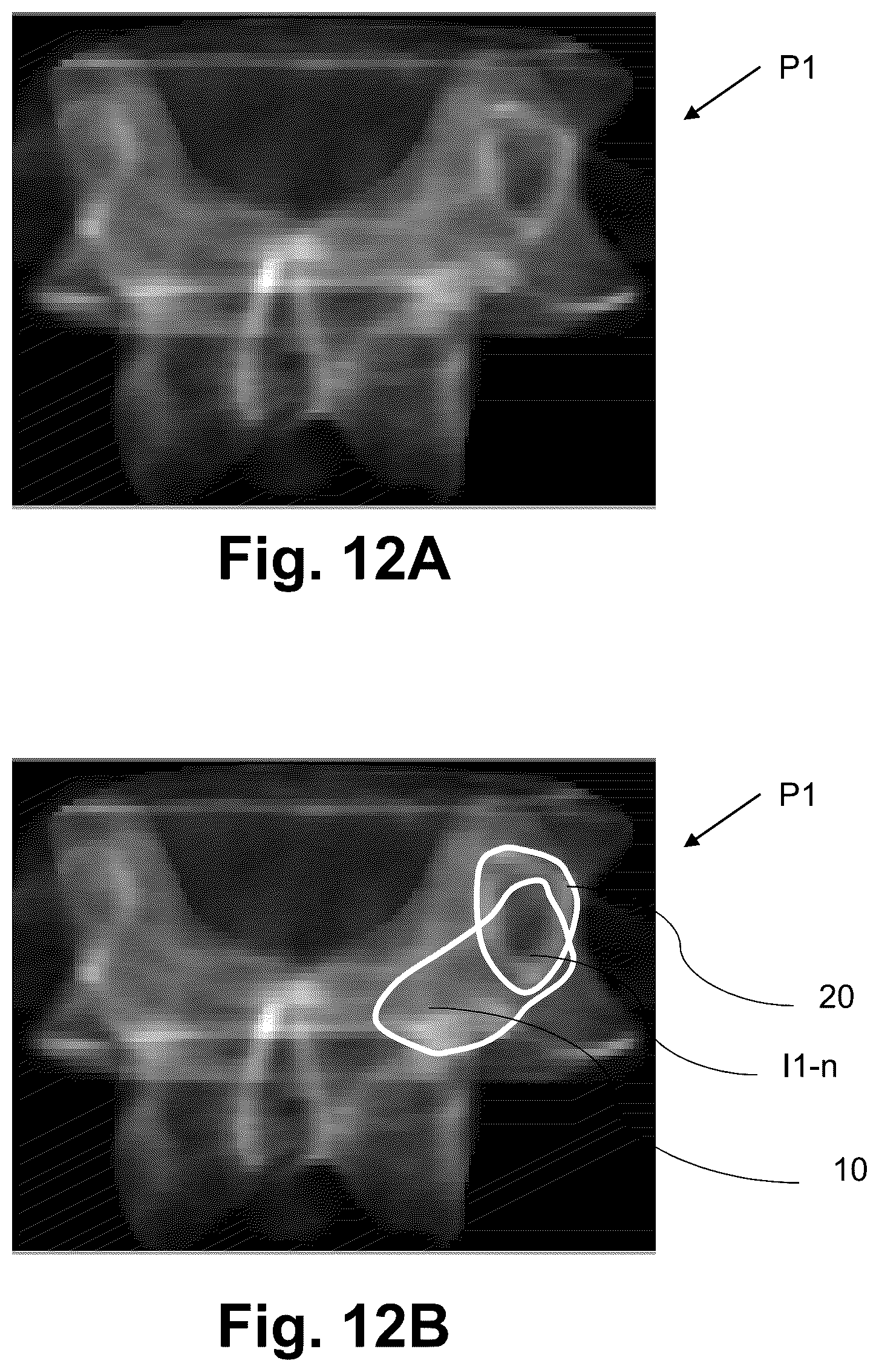 Patent US12616522 Figure 10 – Method for determining the screw trajectory of a pedicle bone screw