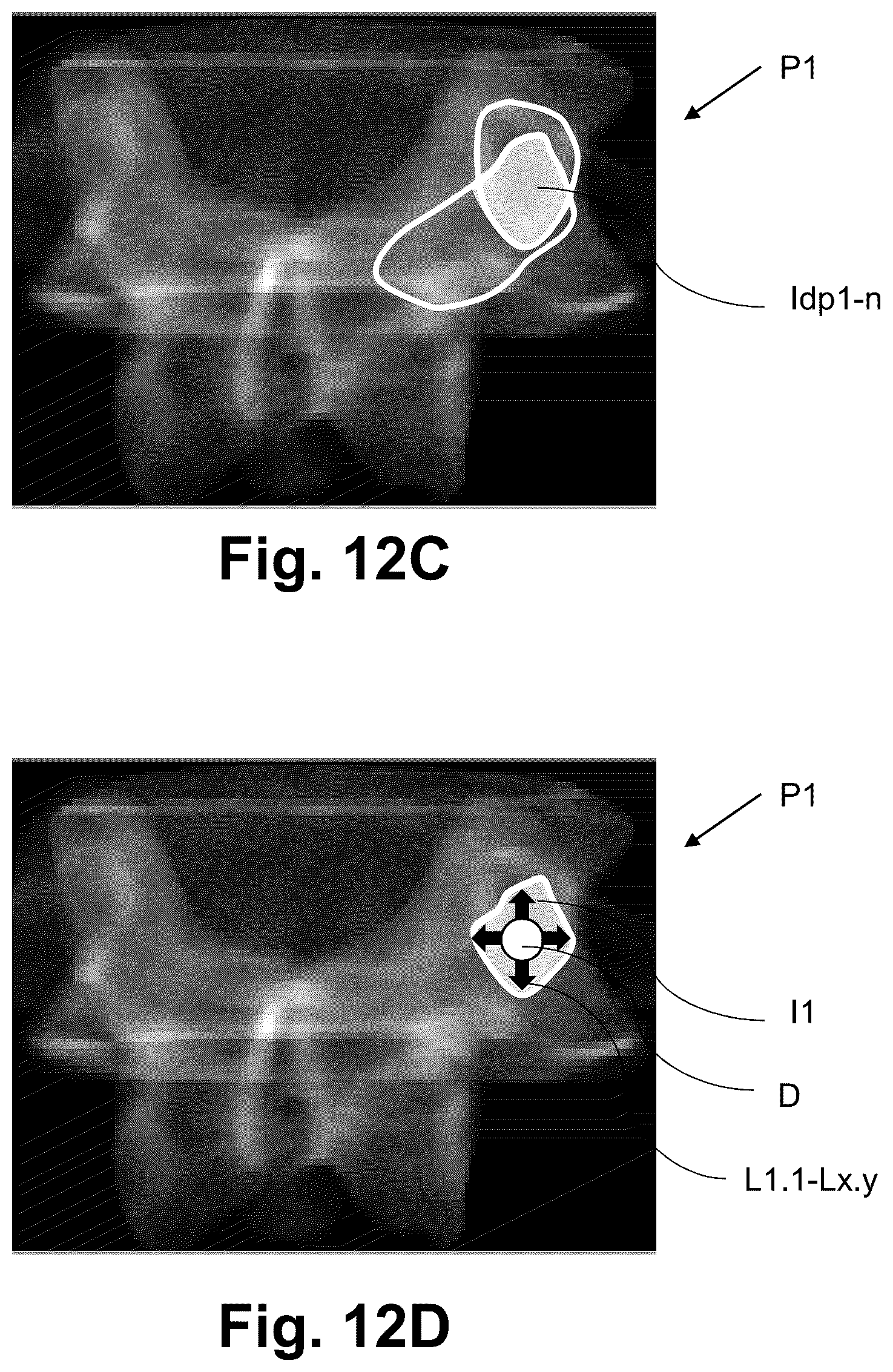 Patent US12616522 Figure 11 – Method for determining the screw trajectory of a pedicle bone screw