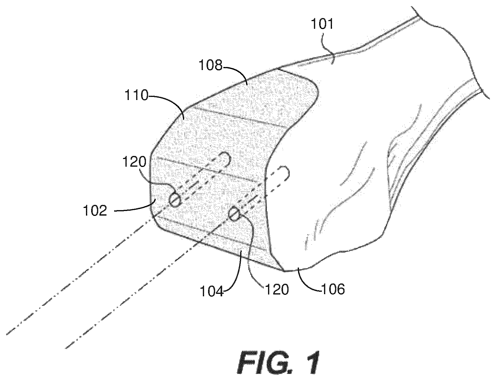 Patent US12616523 Figure 1 – Surgeon preferences and warning visualizations for implant planning
