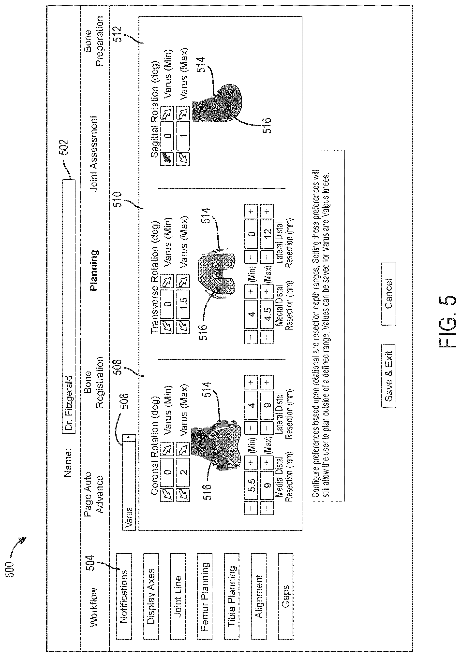 Patent US12616523 Figure 5 – Surgeon preferences and warning visualizations for implant planning