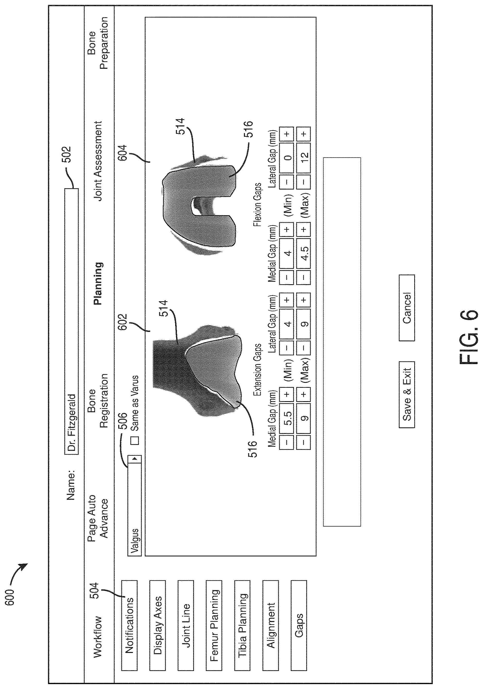 Patent US12616523 Figure 6 – Surgeon preferences and warning visualizations for implant planning