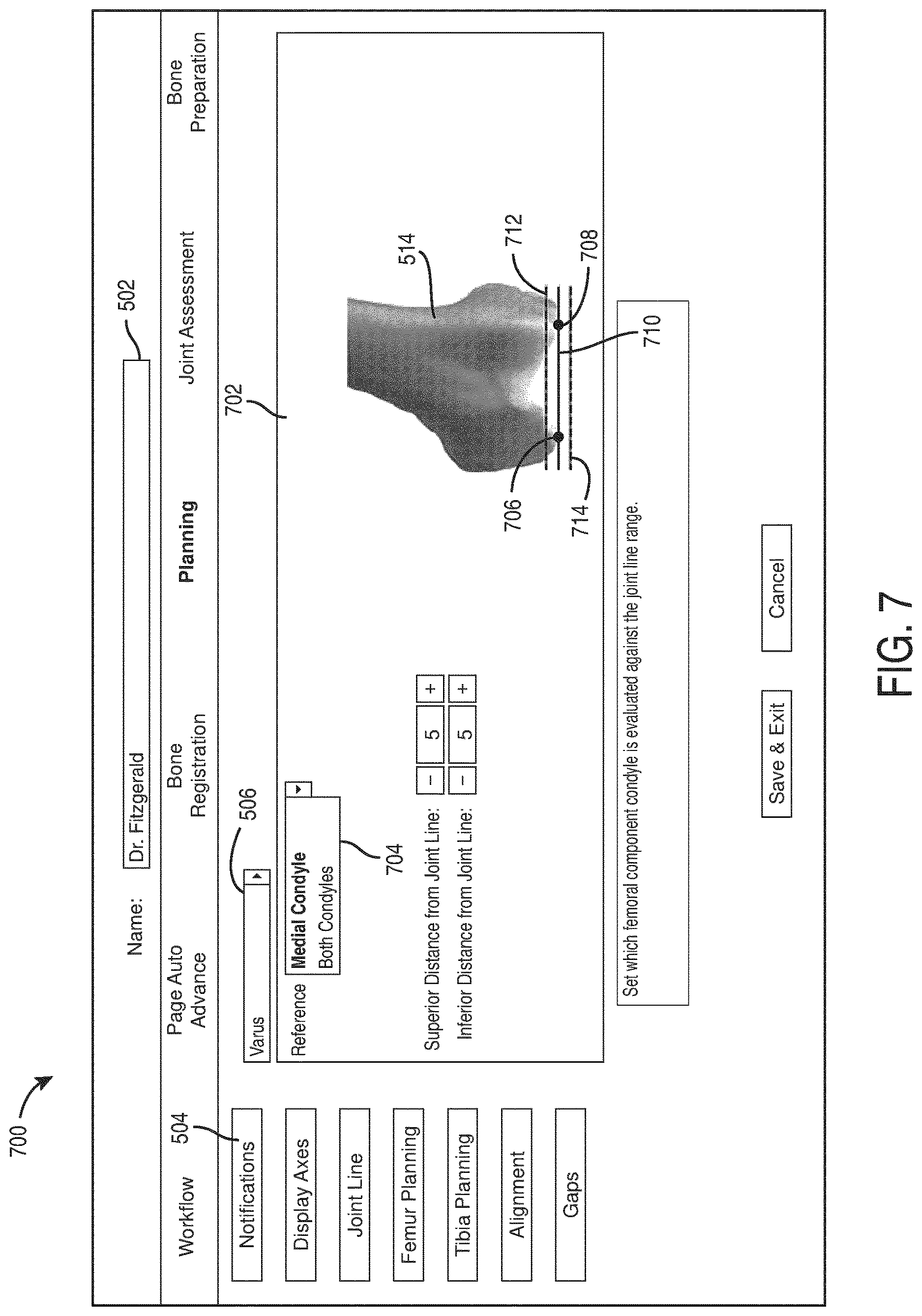 Patent US12616523 Figure 7 – Surgeon preferences and warning visualizations for implant planning