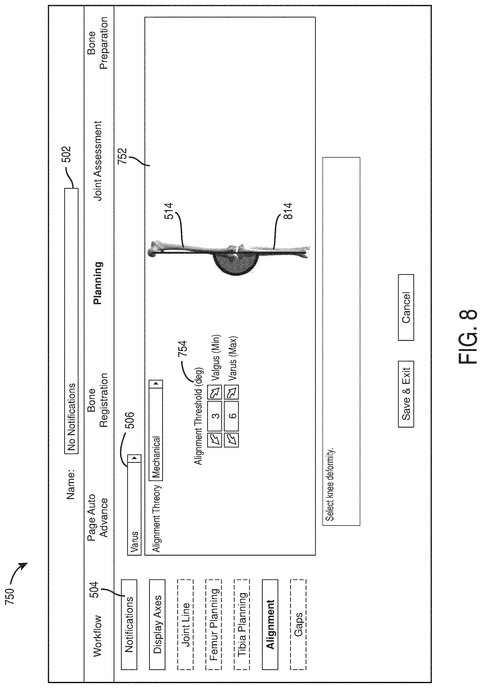 Patent US12616523 Figure 8 – Surgeon preferences and warning visualizations for implant planning