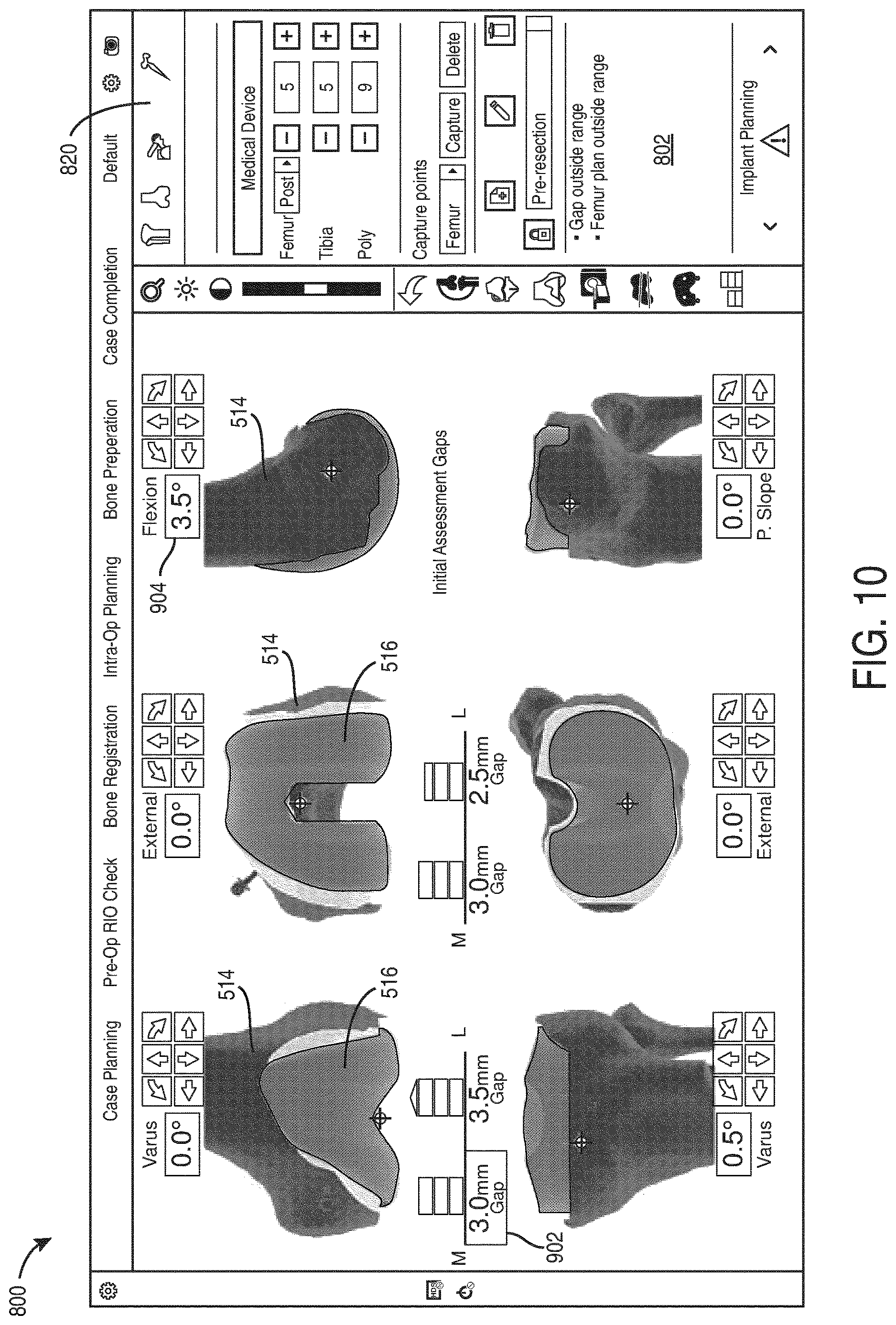 Patent US12616523 Figure 10 – Surgeon preferences and warning visualizations for implant planning