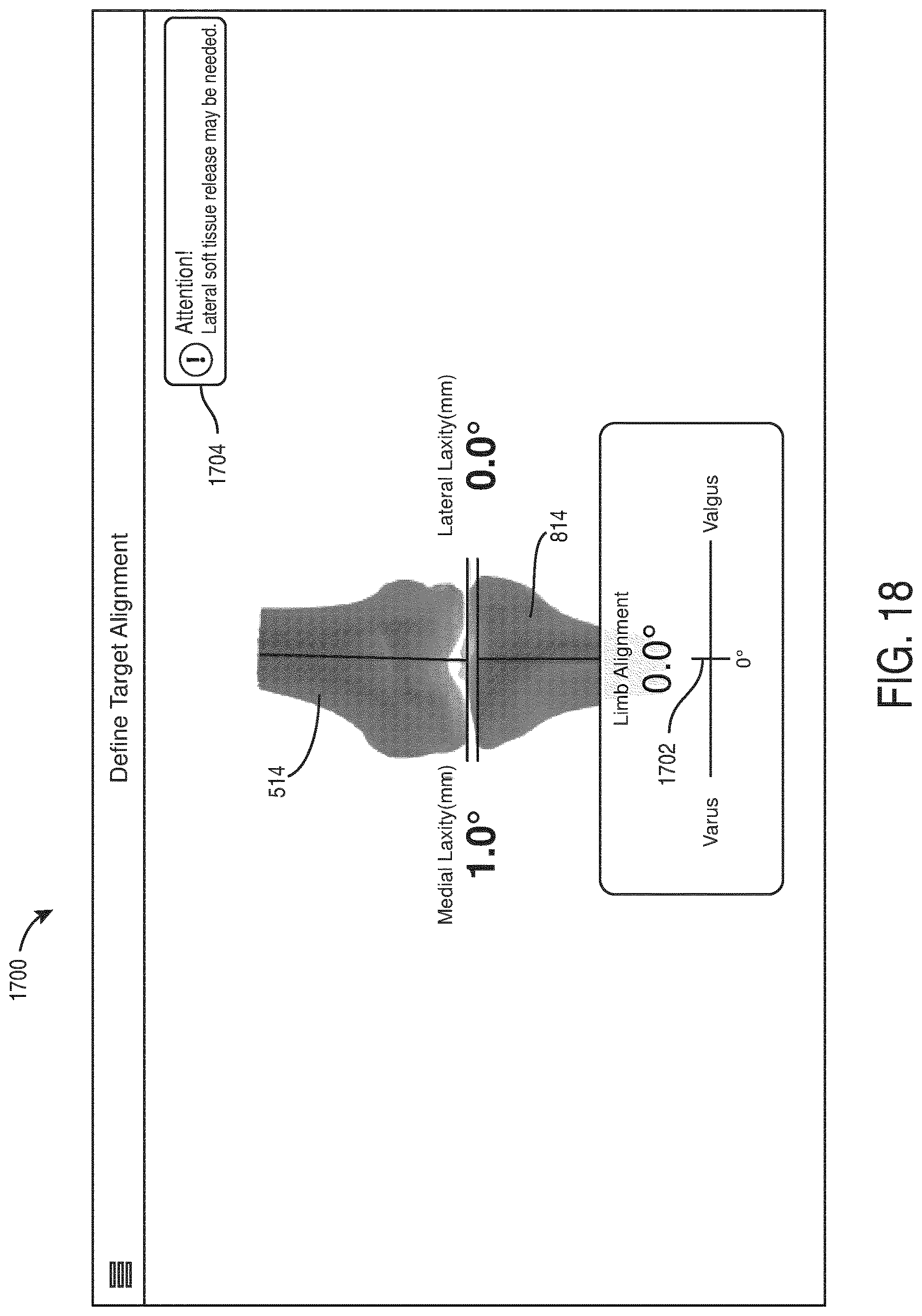 Patent US12616523 Figure 18 – Surgeon preferences and warning visualizations for implant planning