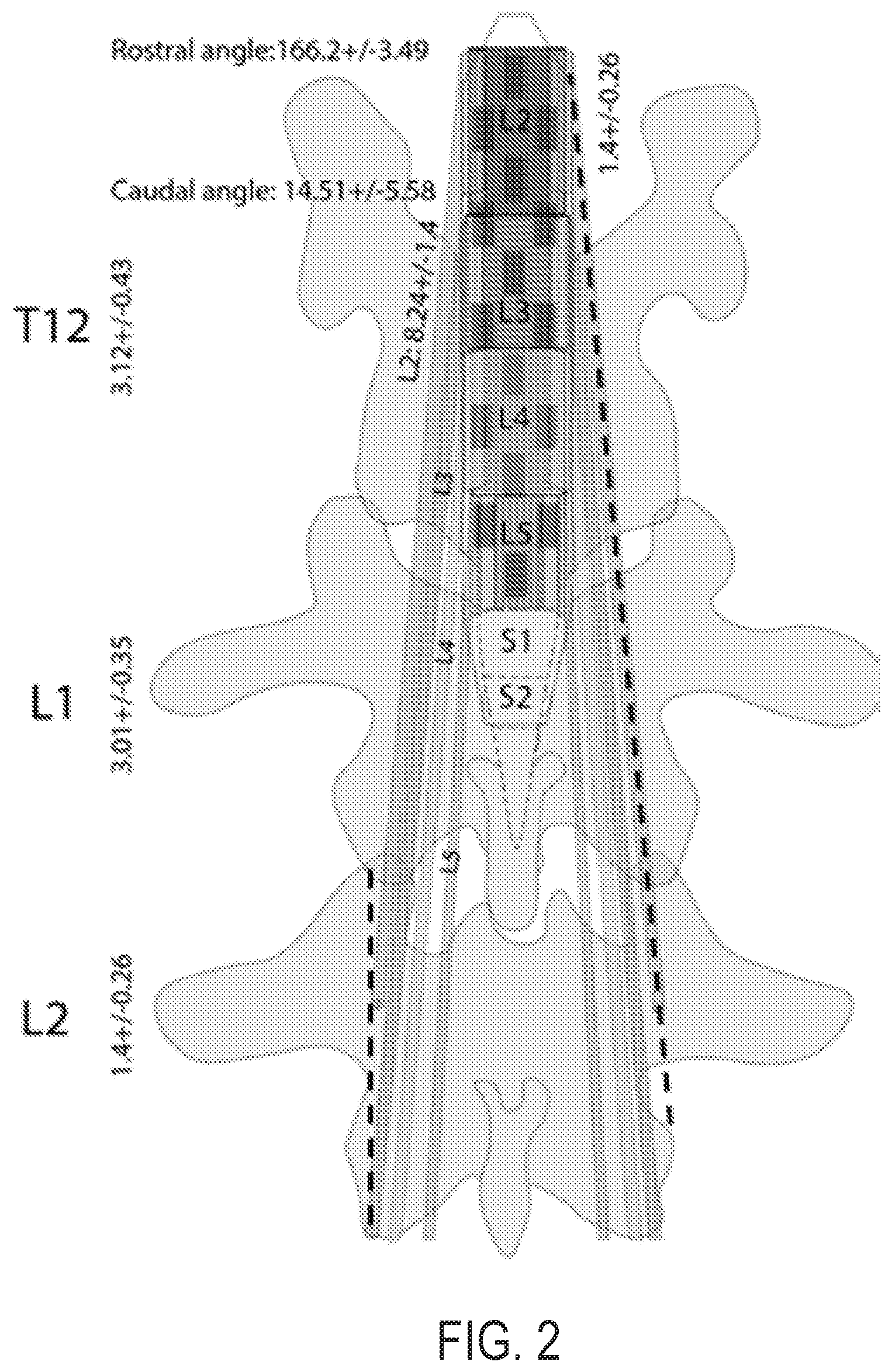 Patent US12616524 Figure 2 – Image-guided navigation system for targeted delivery of spinal cord therapies
