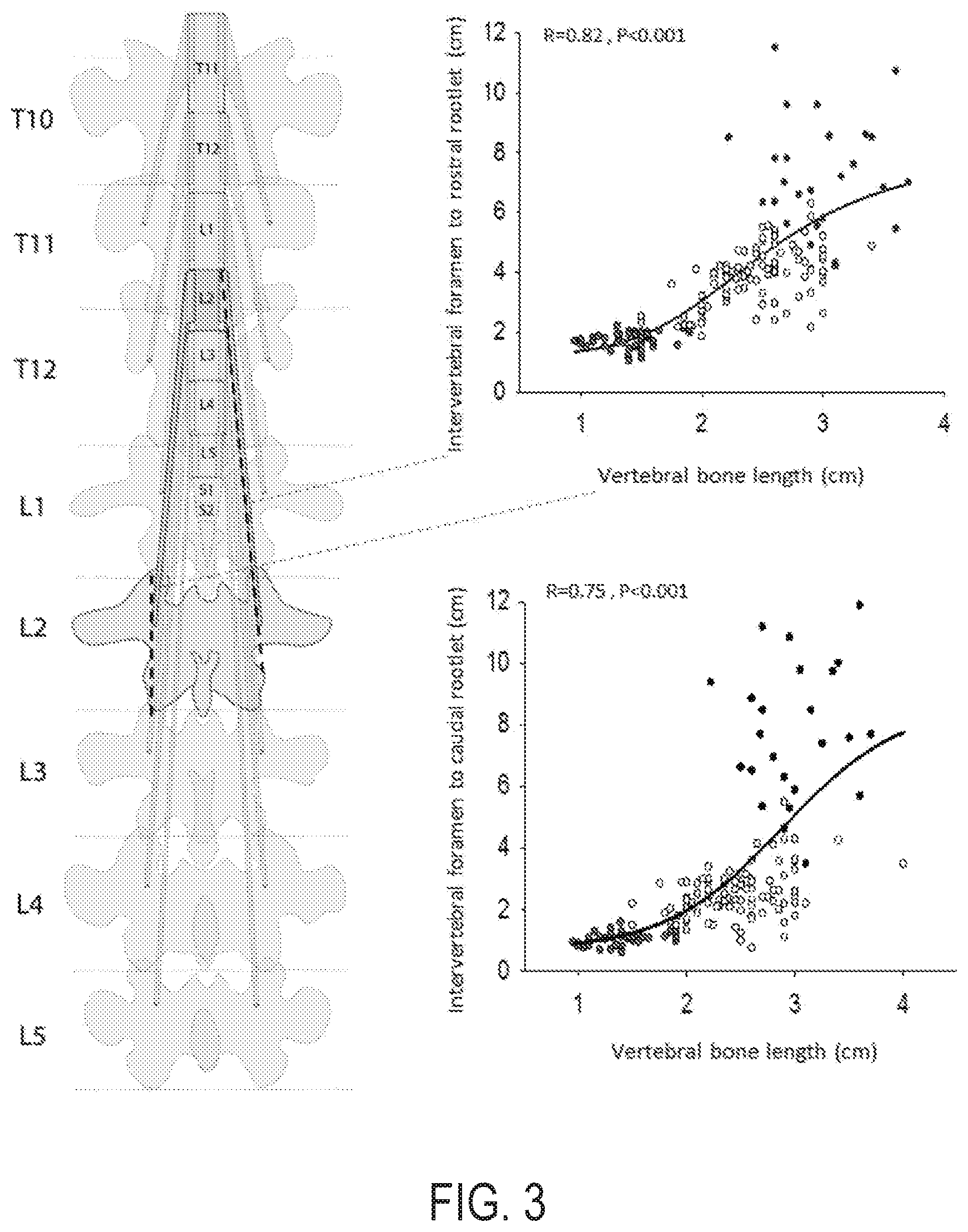 Patent US12616524 Figure 3 – Image-guided navigation system for targeted delivery of spinal cord therapies