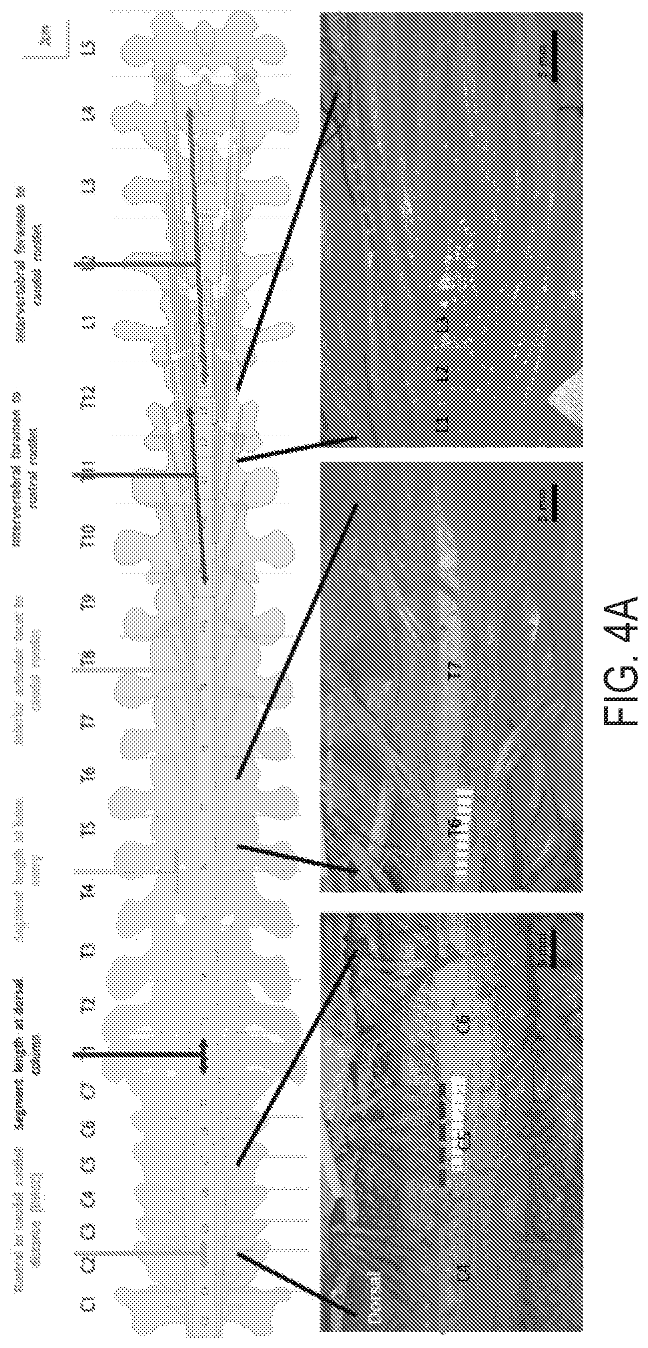 Patent US12616524 Figure 4 – Image-guided navigation system for targeted delivery of spinal cord therapies