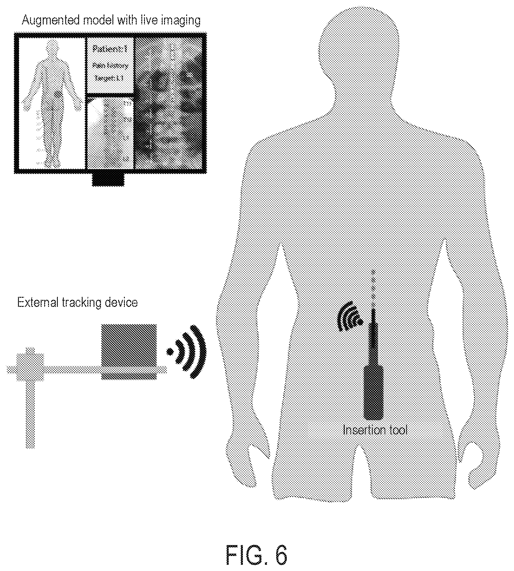 Patent US12616524 Figure 7 – Image-guided navigation system for targeted delivery of spinal cord therapies