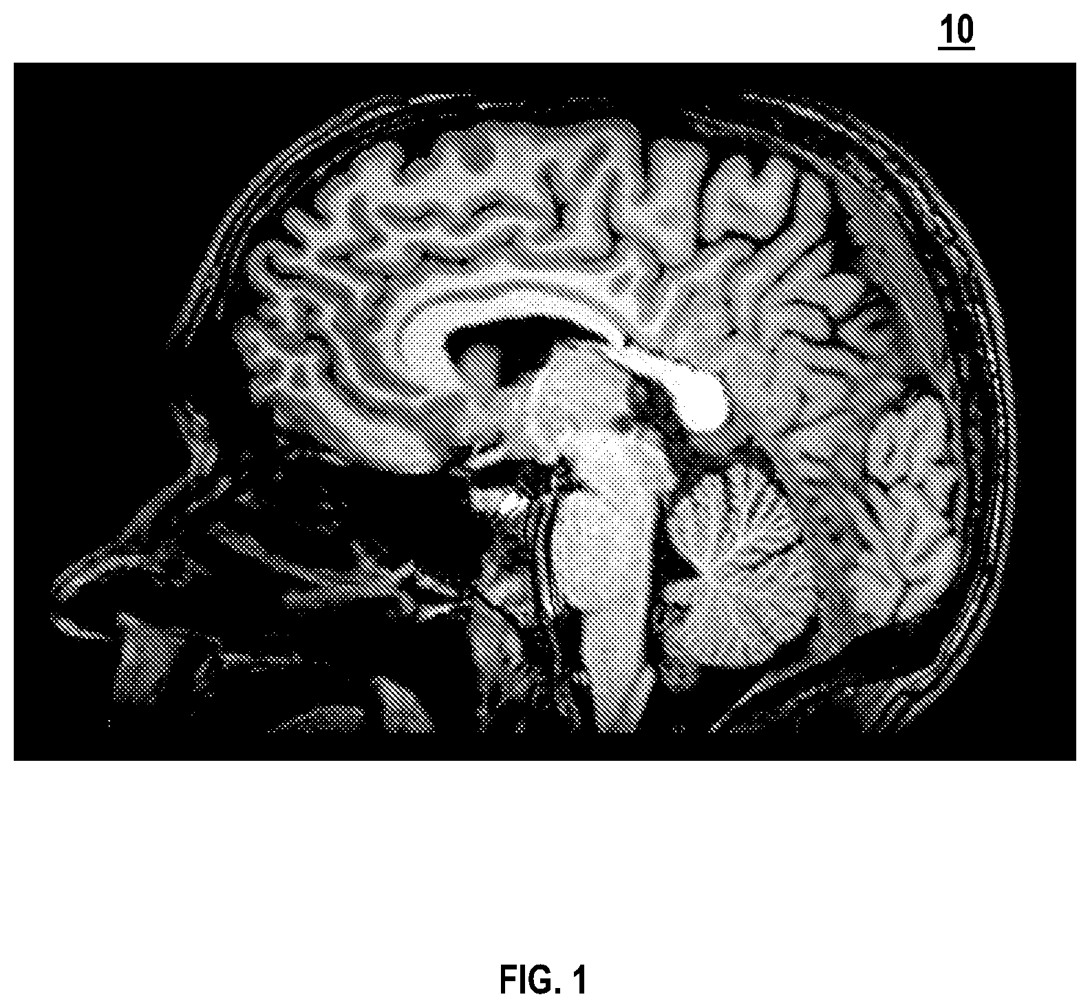 Patent US12616526 Figure 1 – Systems and methods for operative microscope tracking for technical guidance
