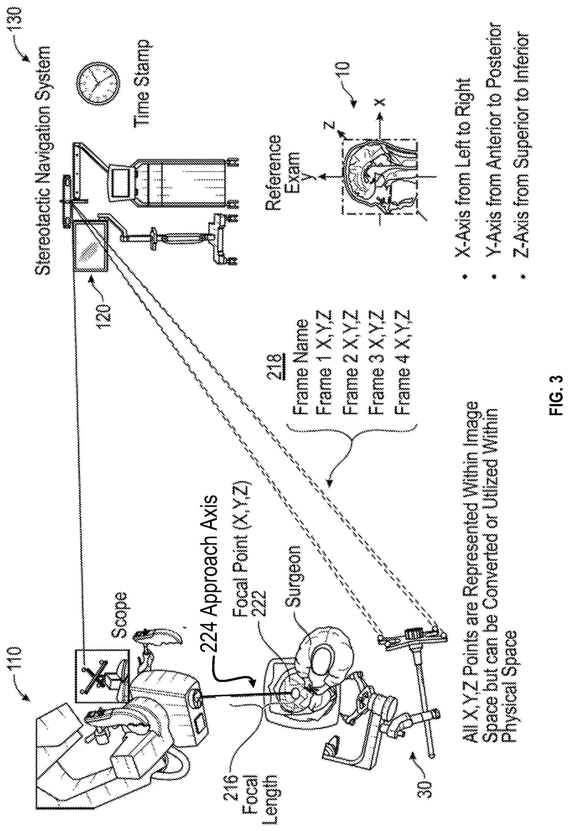 Patent US12616526 Figure 3 – Systems and methods for operative microscope tracking for technical guidance