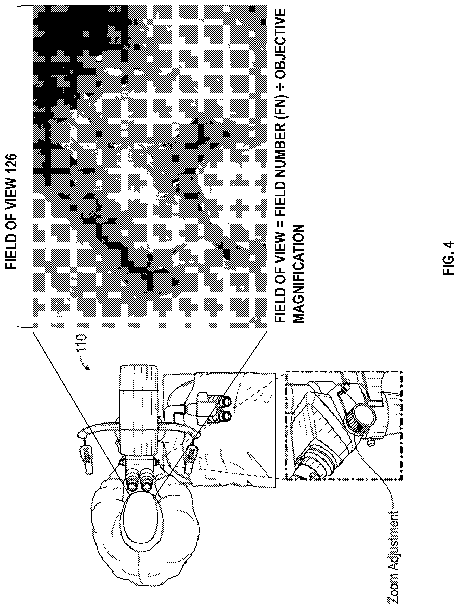 Patent US12616526 Figure 4 – Systems and methods for operative microscope tracking for technical guidance