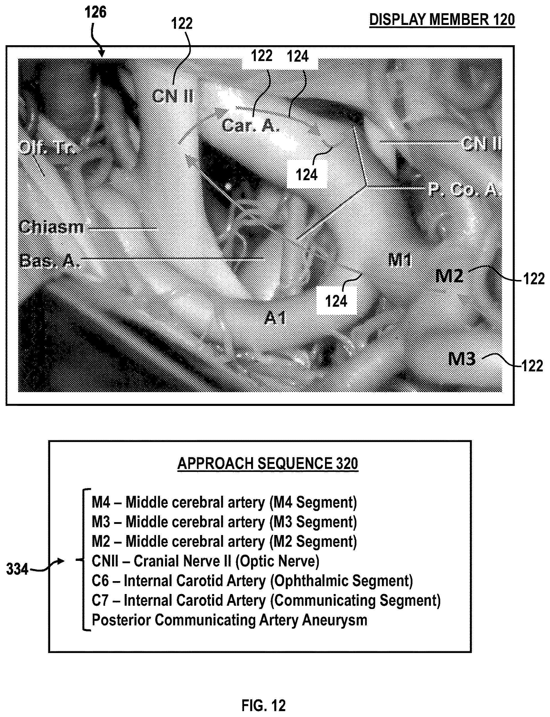 Patent US12616526 Figure 13 – Systems and methods for operative microscope tracking for technical guidance