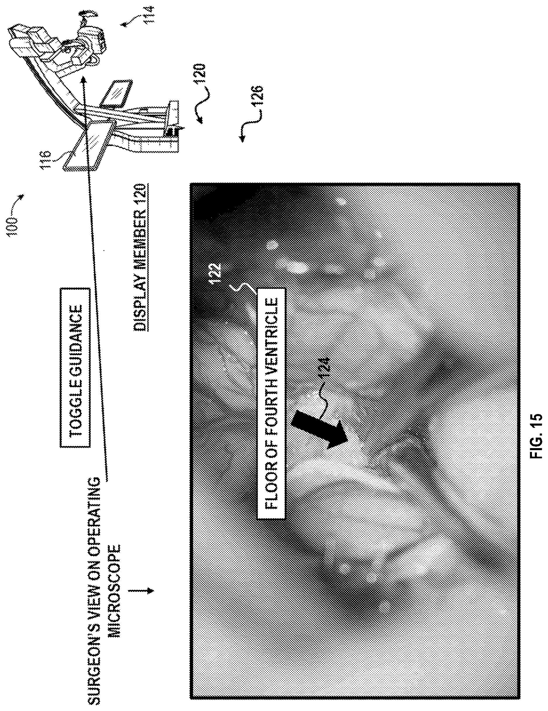 Patent US12616526 Figure 16 – Systems and methods for operative microscope tracking for technical guidance