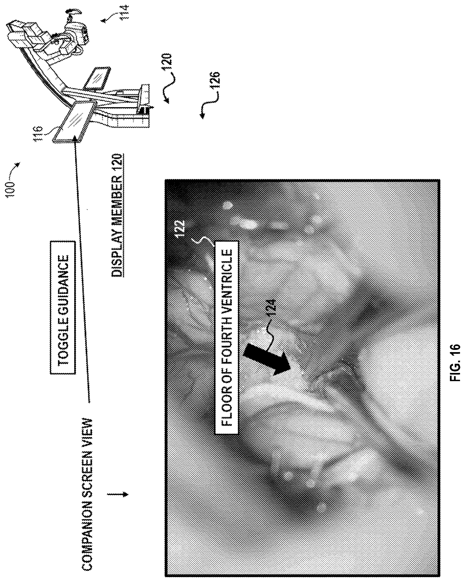 Patent US12616526 Figure 17 – Systems and methods for operative microscope tracking for technical guidance