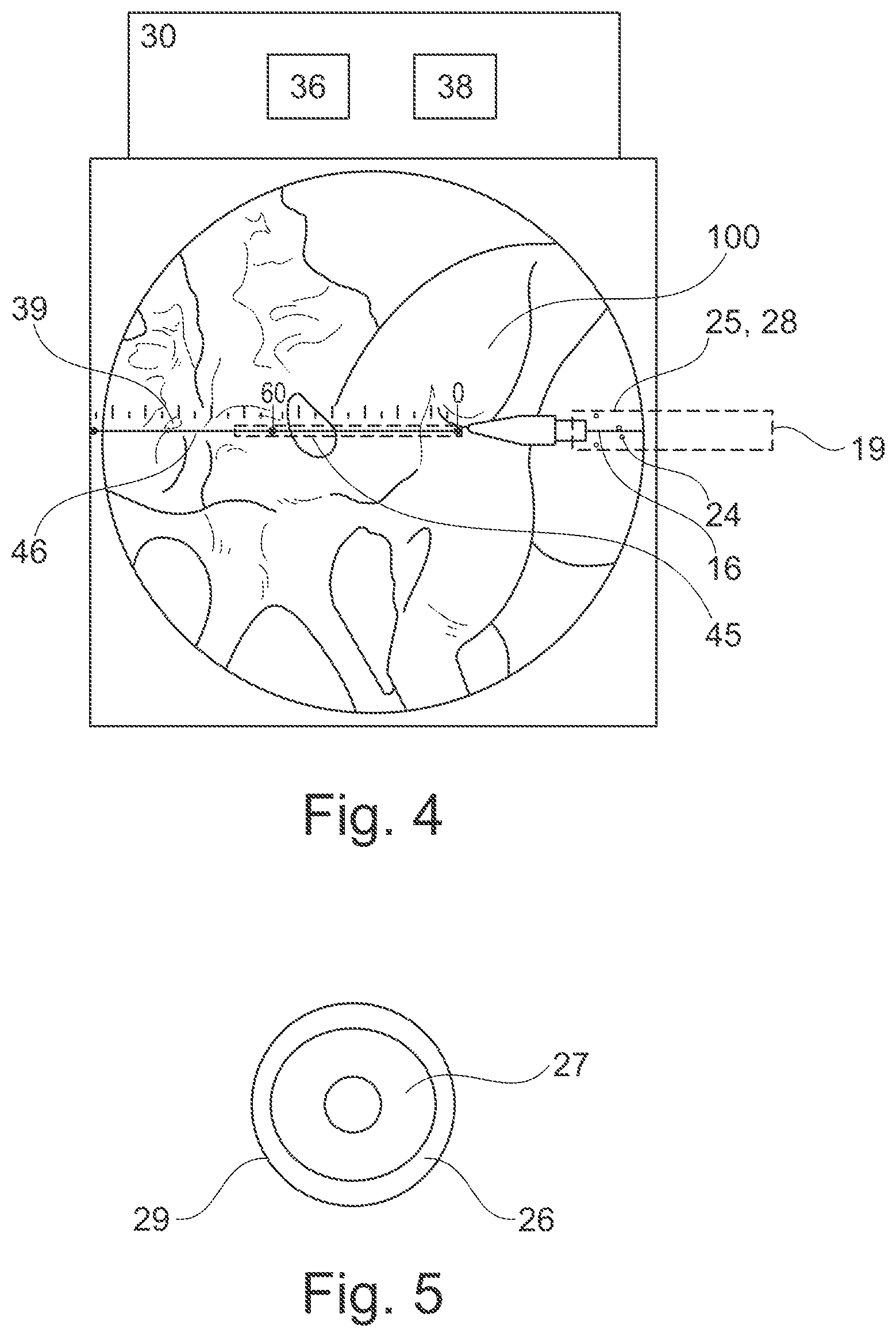 Patent US12616527 Figure 2 – Surgical tracking system for tracking an instrument with respect to a reference body