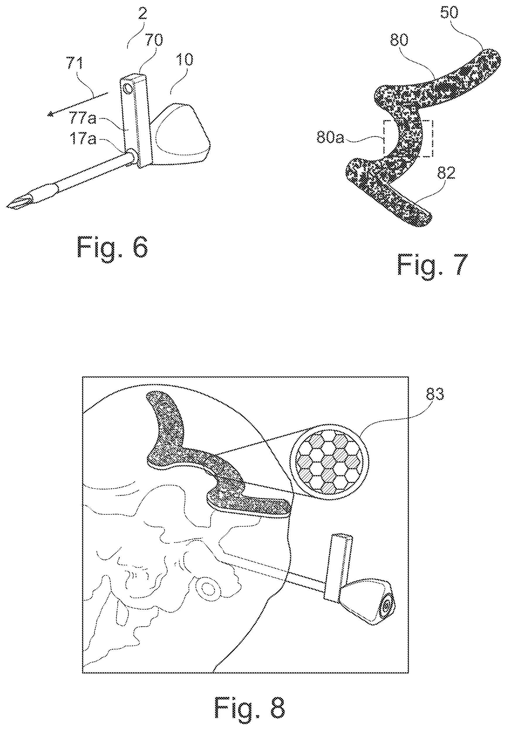 Patent US12616527 Figure 3 – Surgical tracking system for tracking an instrument with respect to a reference body
