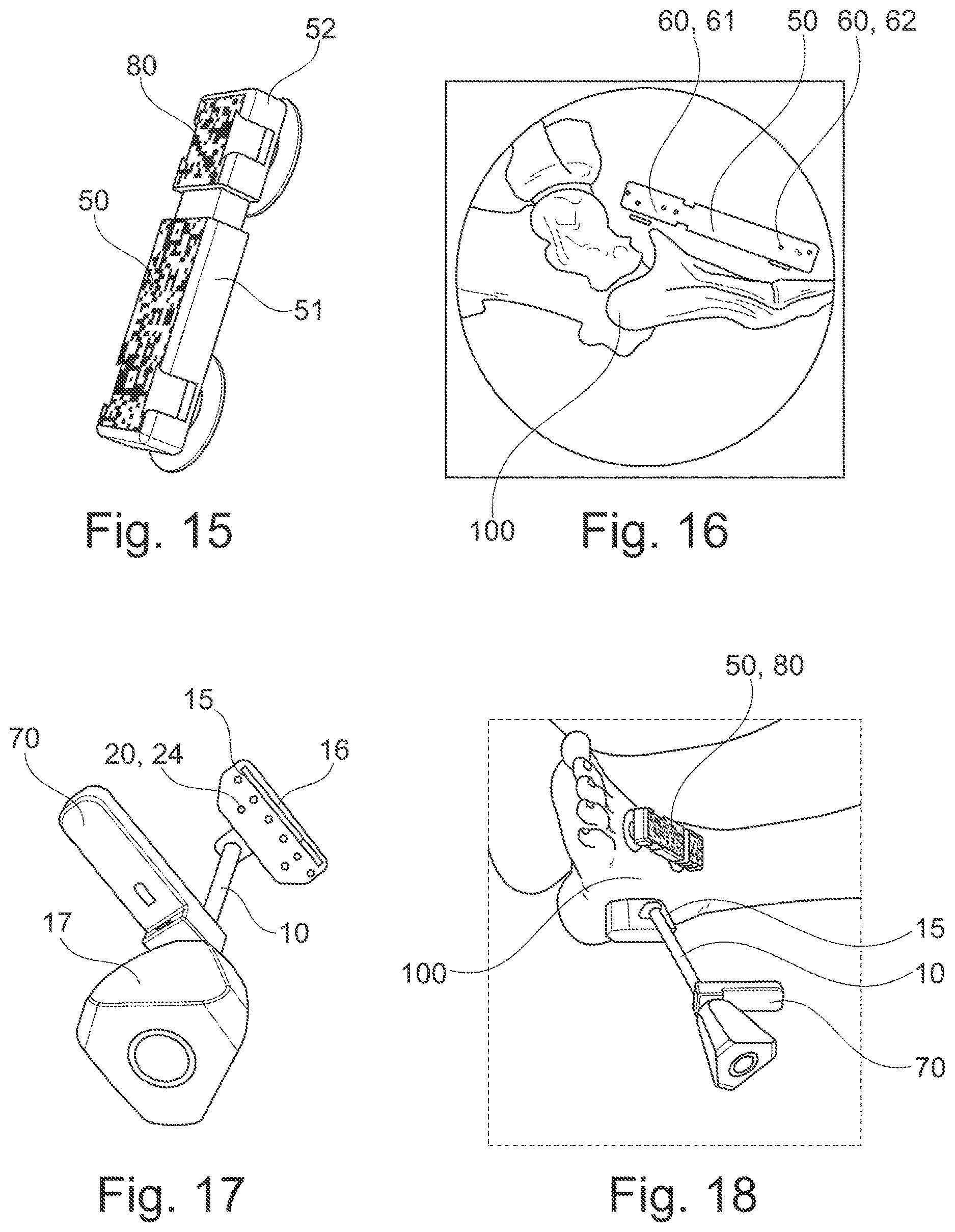 Patent US12616527 Figure 7 – Surgical tracking system for tracking an instrument with respect to a reference body