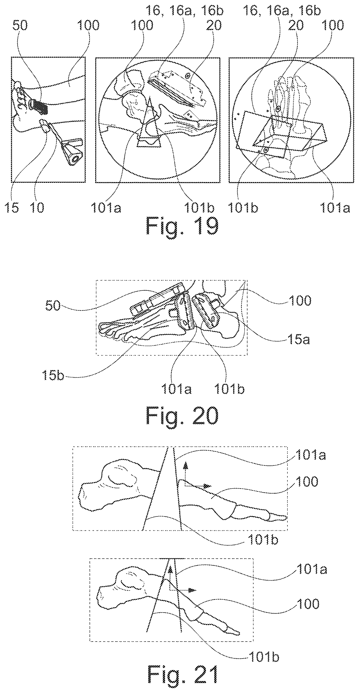 Patent US12616527 Figure 8 – Surgical tracking system for tracking an instrument with respect to a reference body