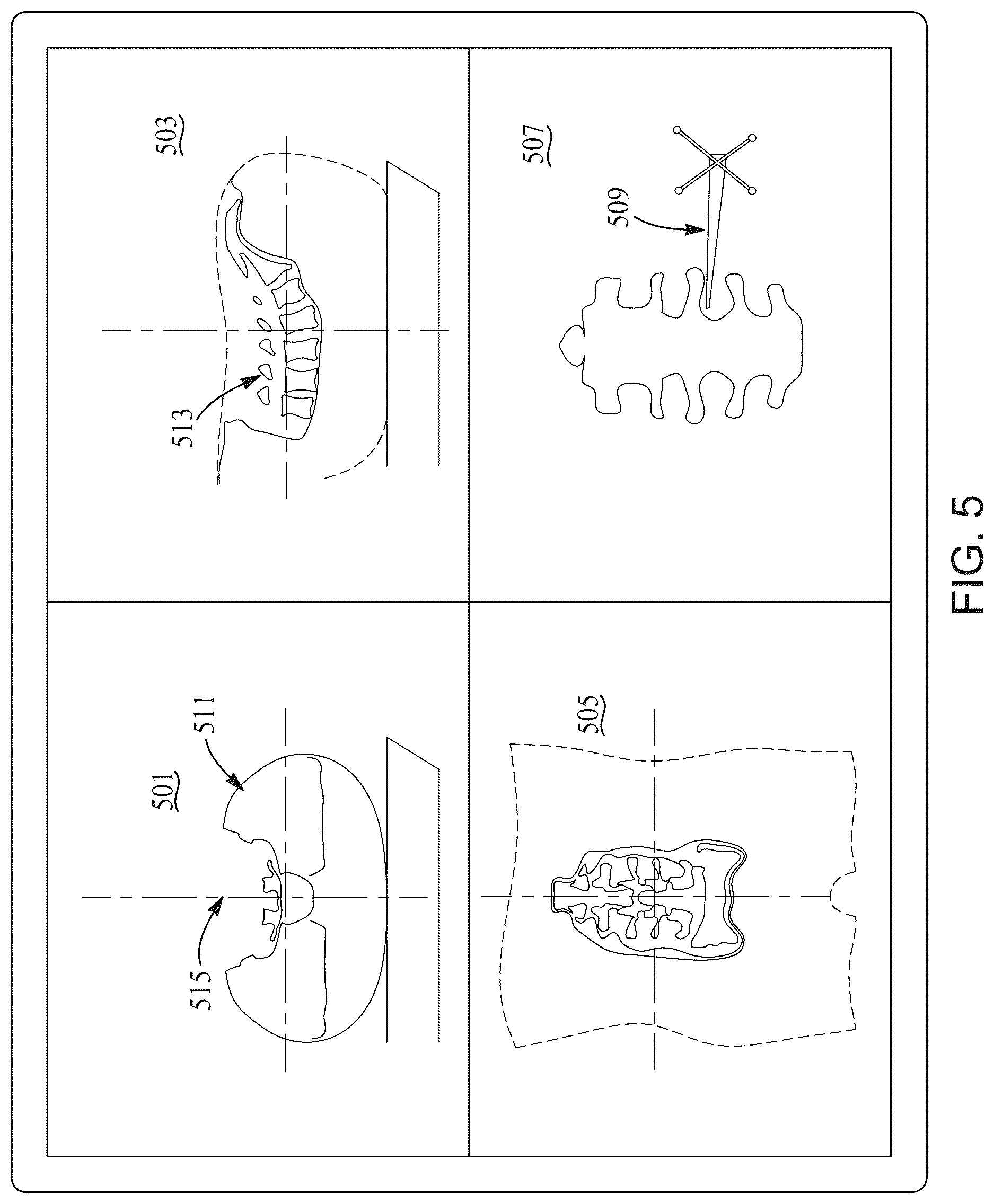 Patent US12616528 Figure 5 – Methods and systems for performing computer assisted surgery