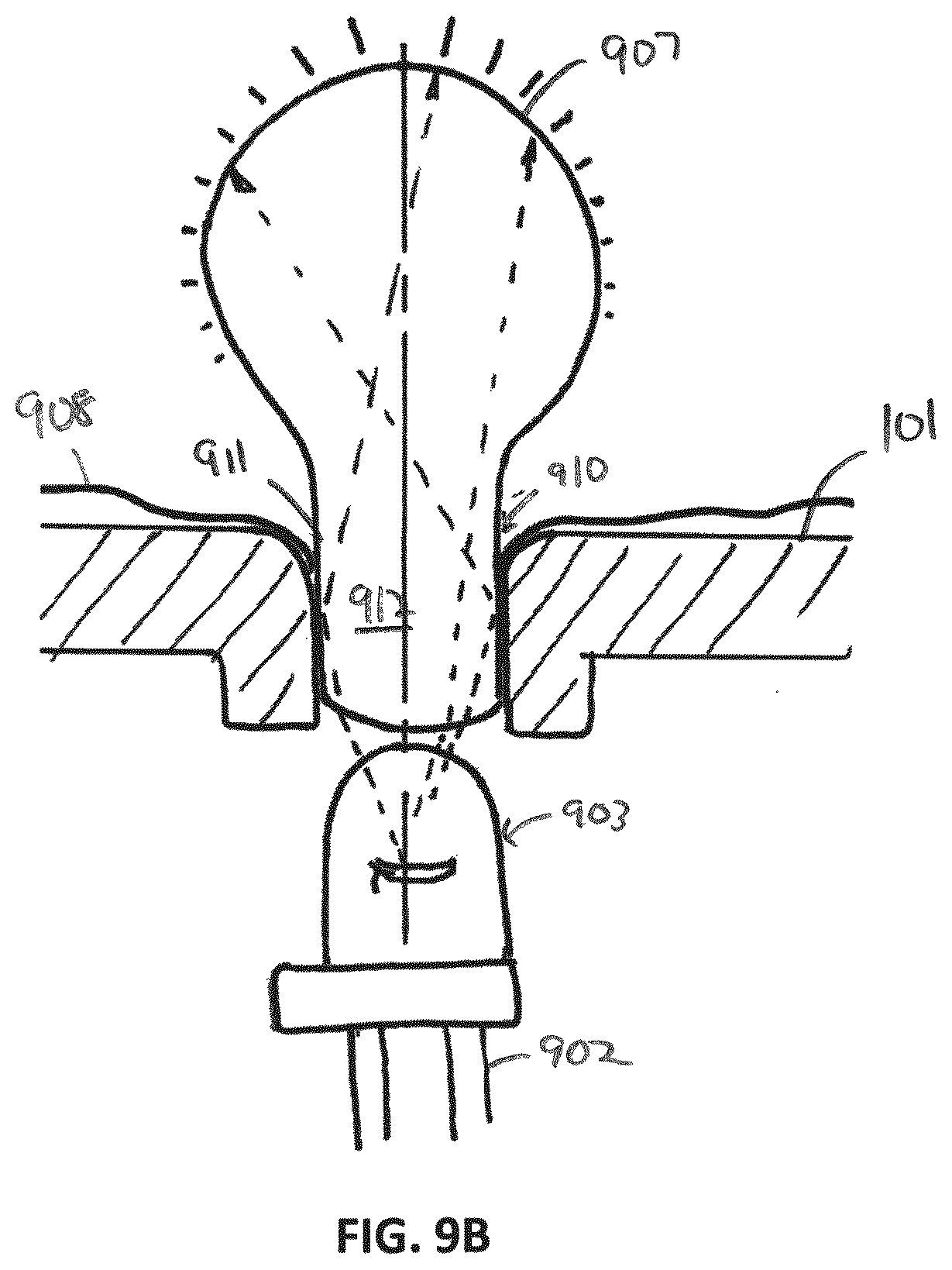 Patent US12616528 Figure 15 – Methods and systems for performing computer assisted surgery