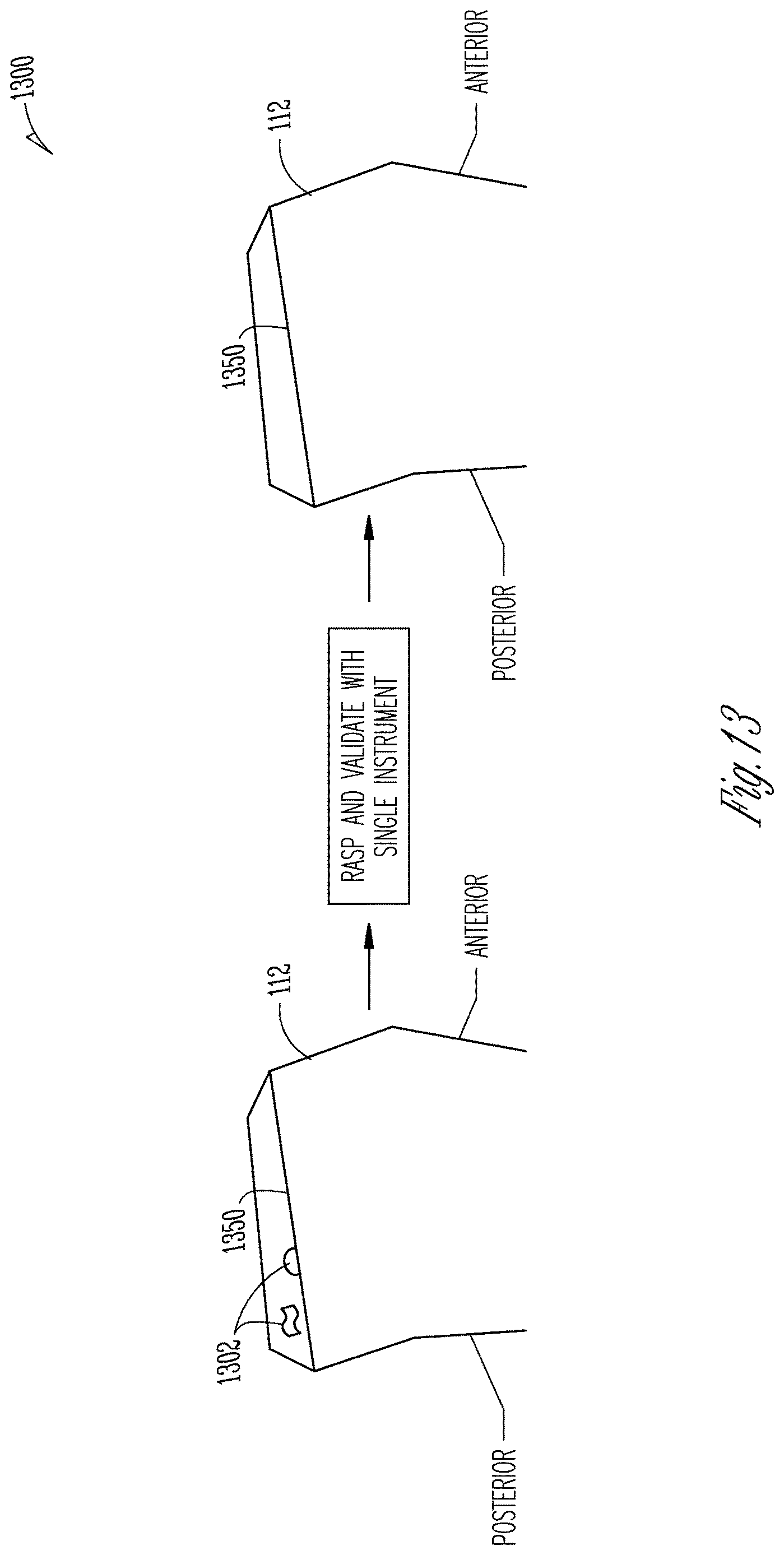 Patent US12616530 Figure 8 – Knee arthroplasty combination validation instrument and bone removal tool