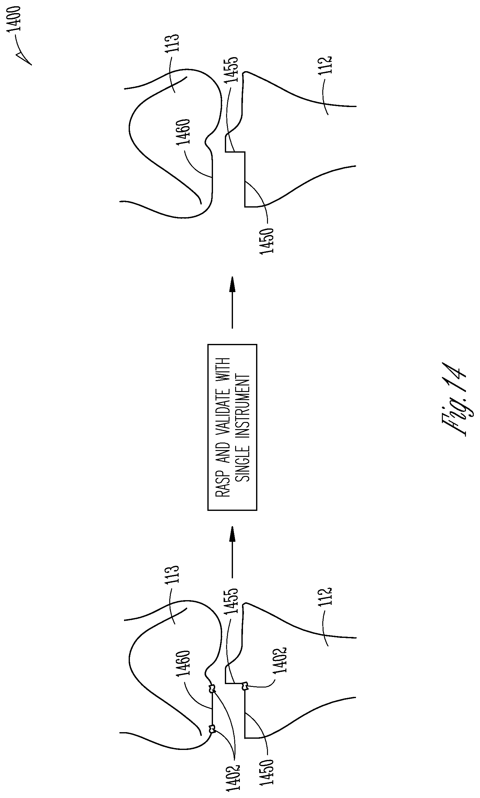 Patent US12616530 Figure 9 – Knee arthroplasty combination validation instrument and bone removal tool