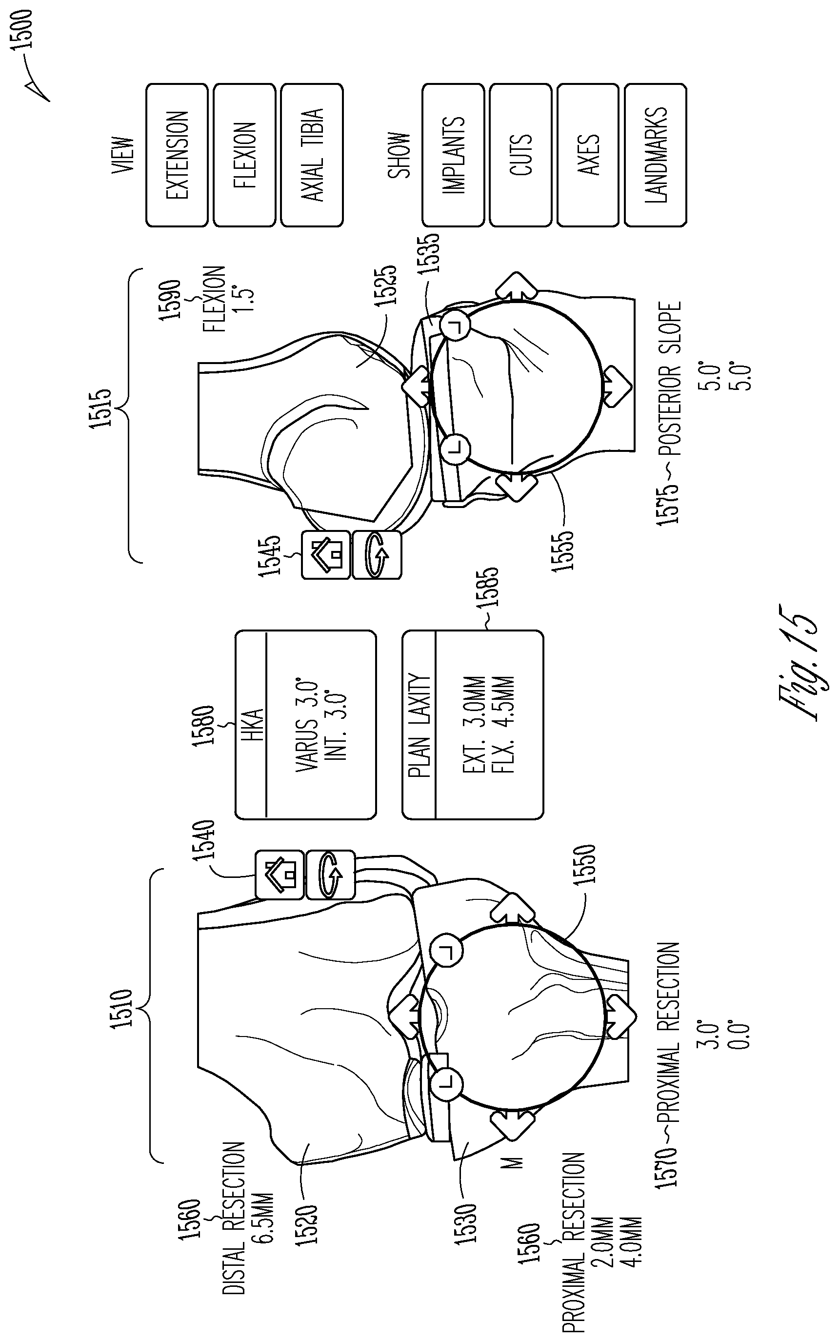 Patent US12616530 Figure 10 – Knee arthroplasty combination validation instrument and bone removal tool