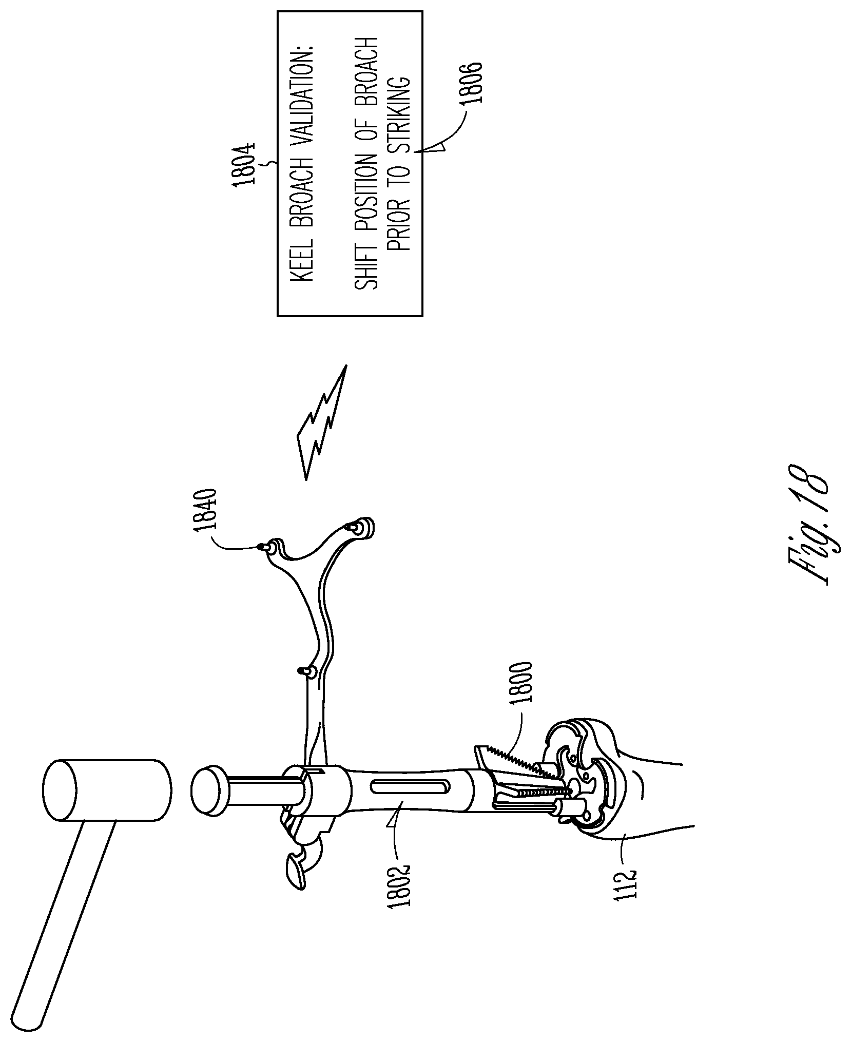 Patent US12616530 Figure 13 – Knee arthroplasty combination validation instrument and bone removal tool