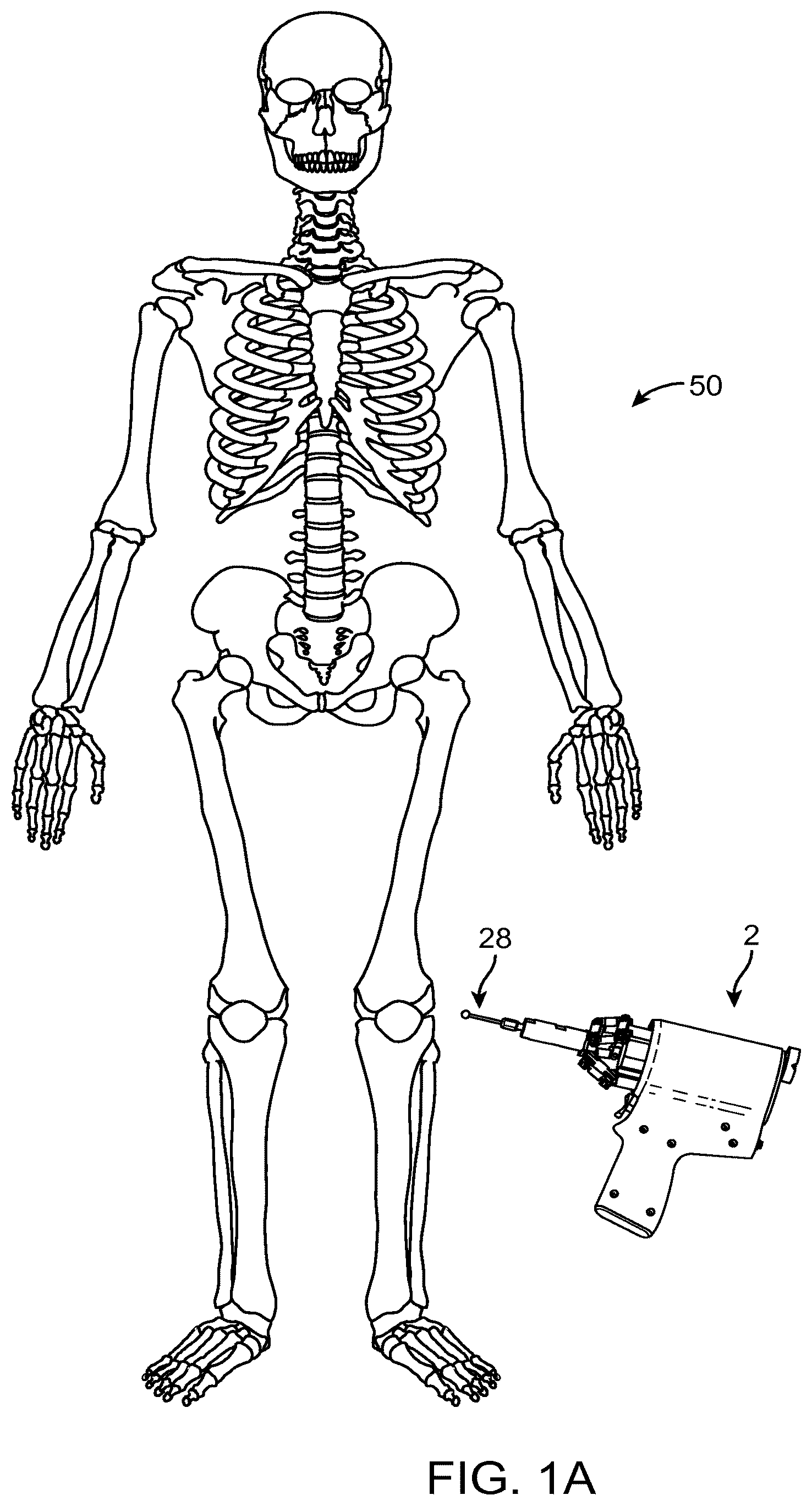 Patent US12616535 Figure 1 – Systems and methods for handheld robotic surgery