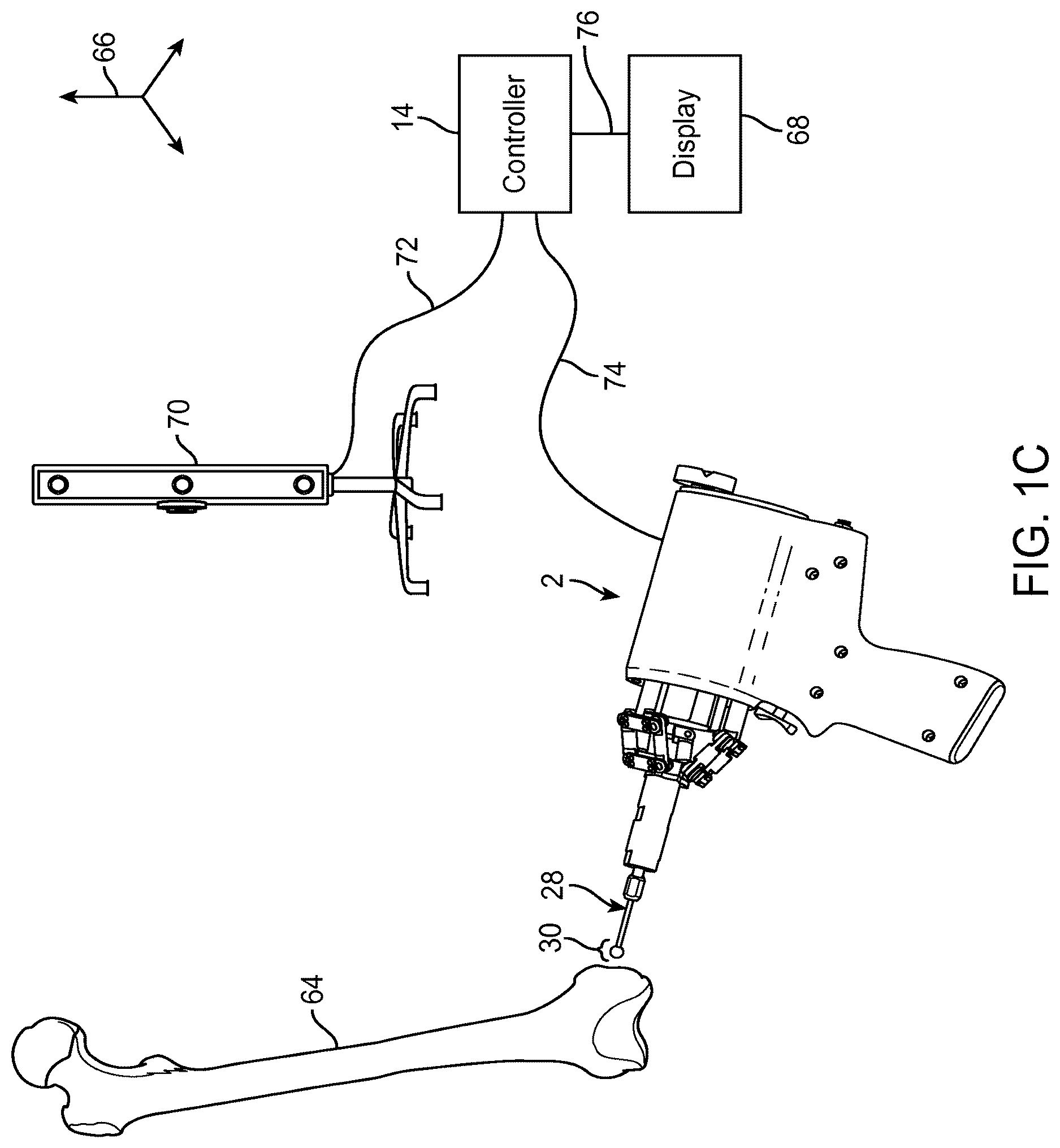 Patent US12616535 Figure 3 – Systems and methods for handheld robotic surgery