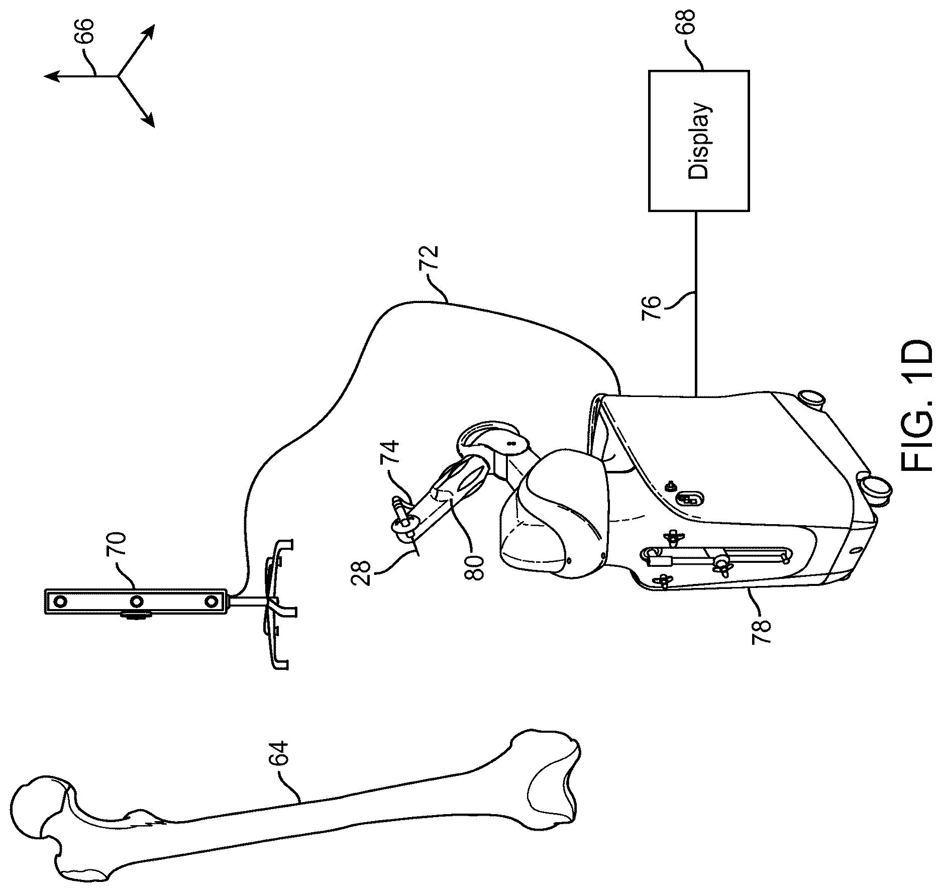 Patent US12616535 Figure 4 – Systems and methods for handheld robotic surgery