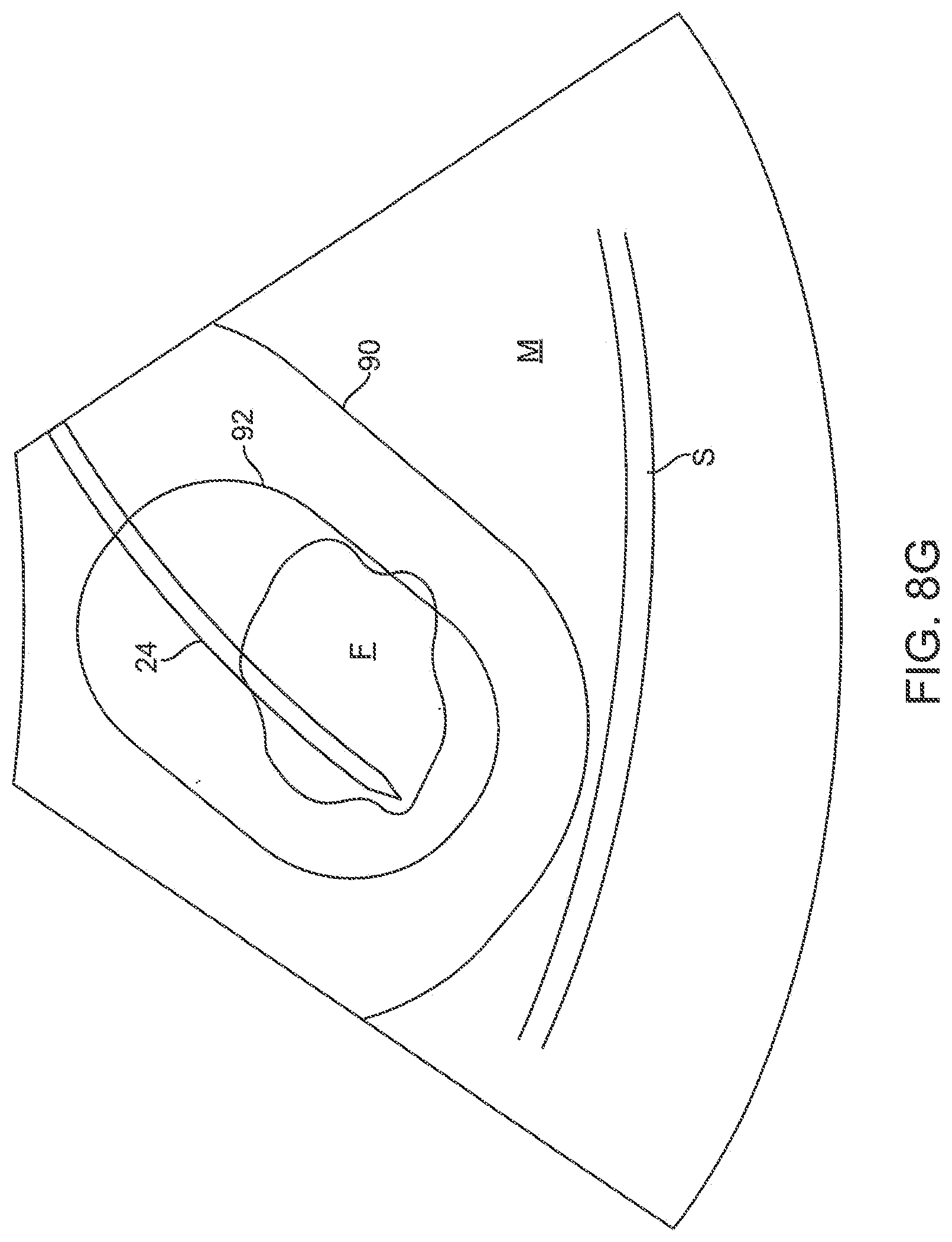 Patent US12616549 Figure 14 – Methods and systems for controlled deployment of needles in tissue