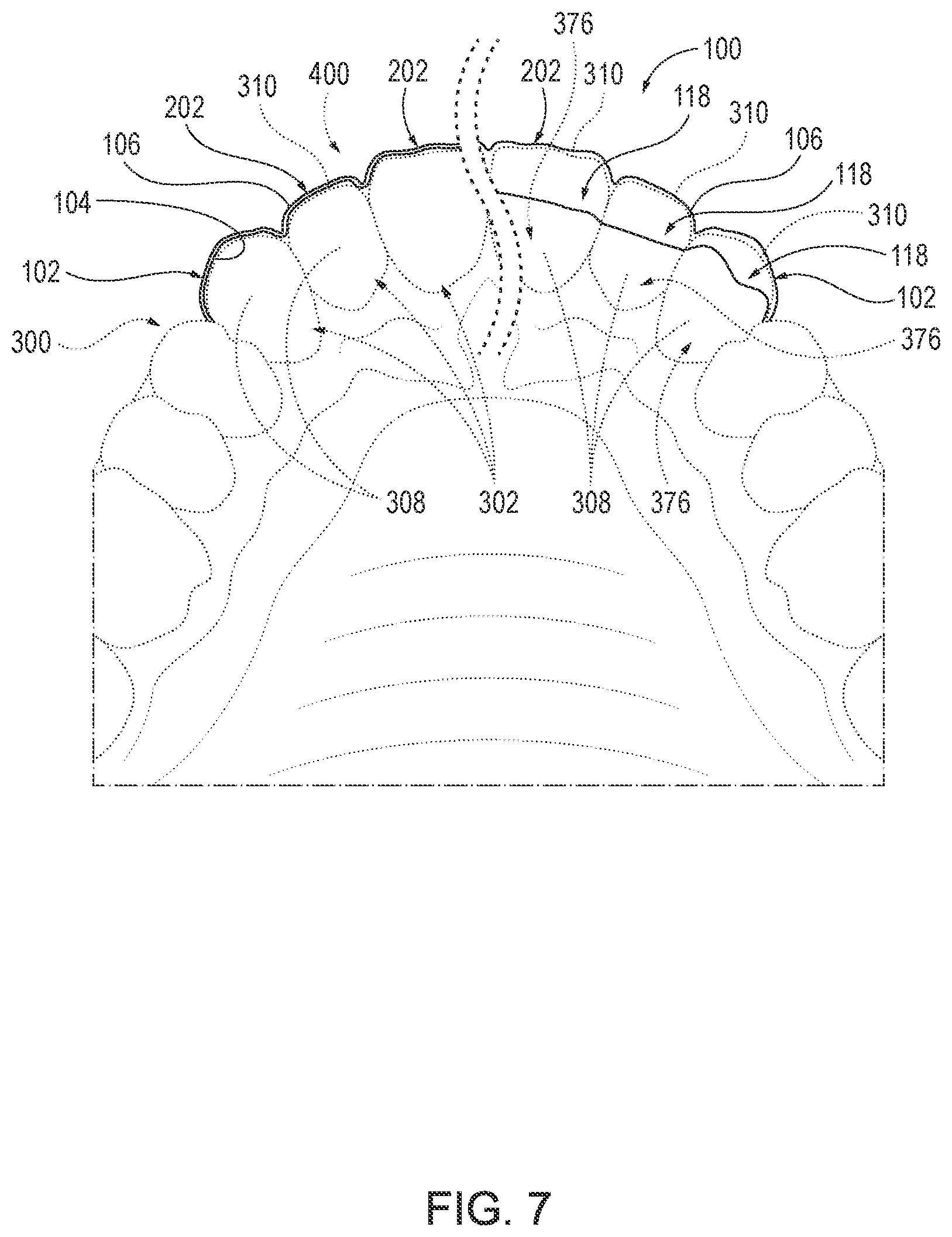 Patent US12616554 Figure 5 – Customized temporary veneers and methods of providing the same