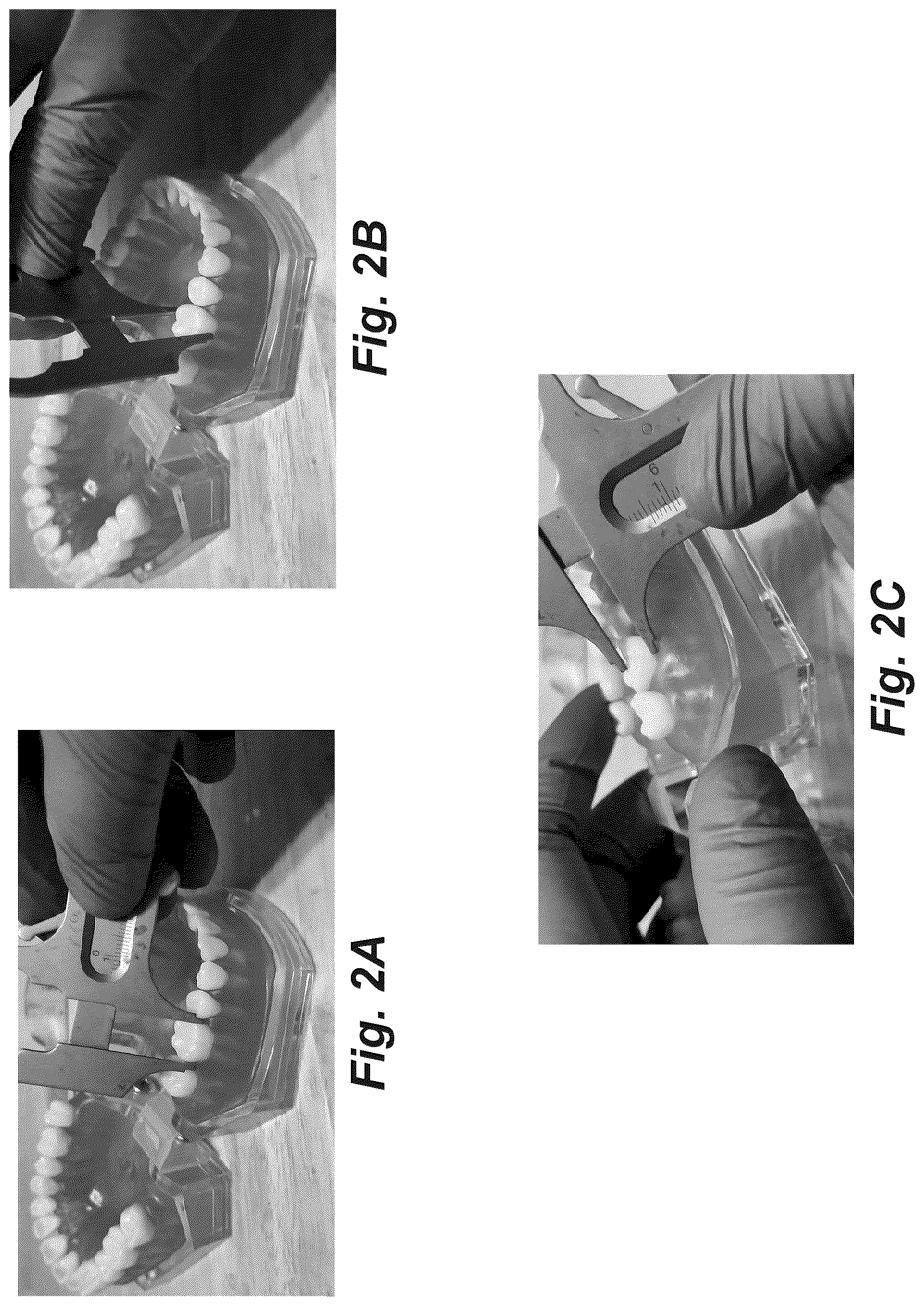 Patent US12616555 Figure 4 – Dental crown and method of use