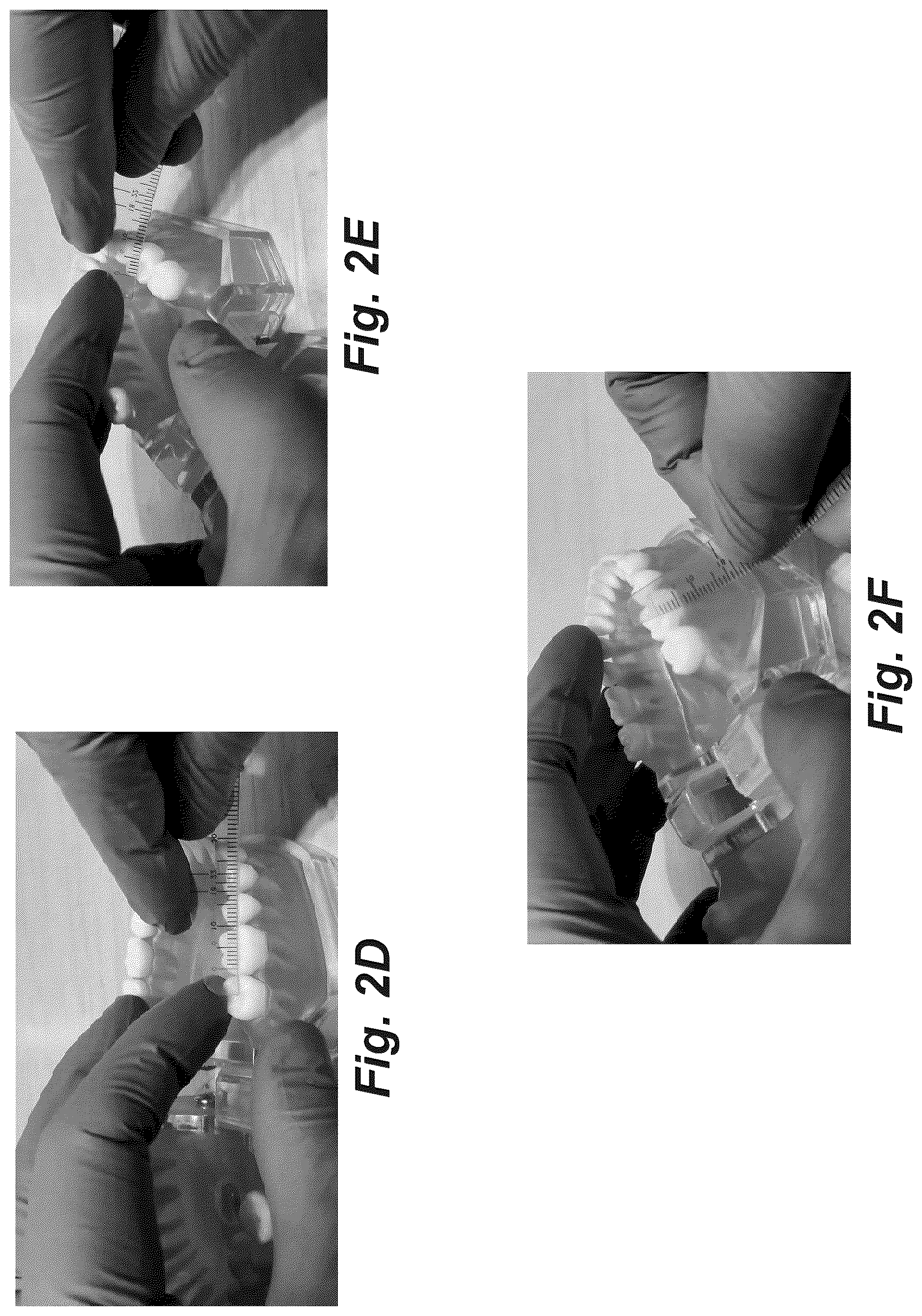Patent US12616555 Figure 5 – Dental crown and method of use