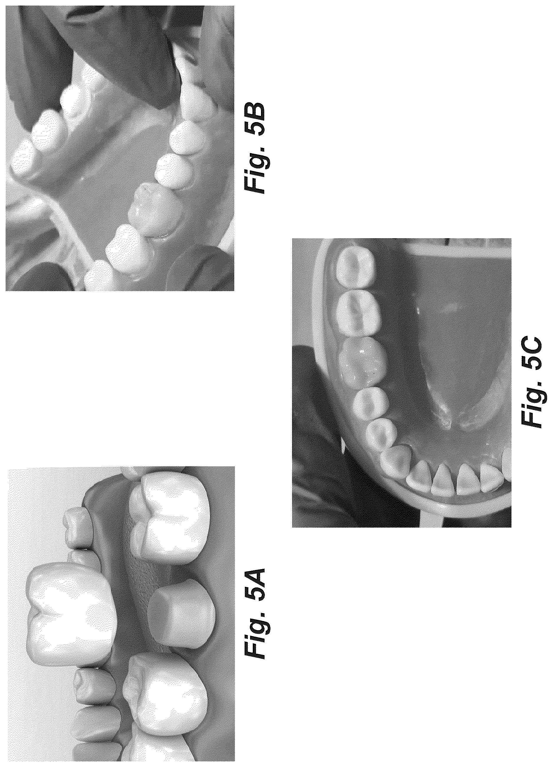Patent US12616555 Figure 8 – Dental crown and method of use