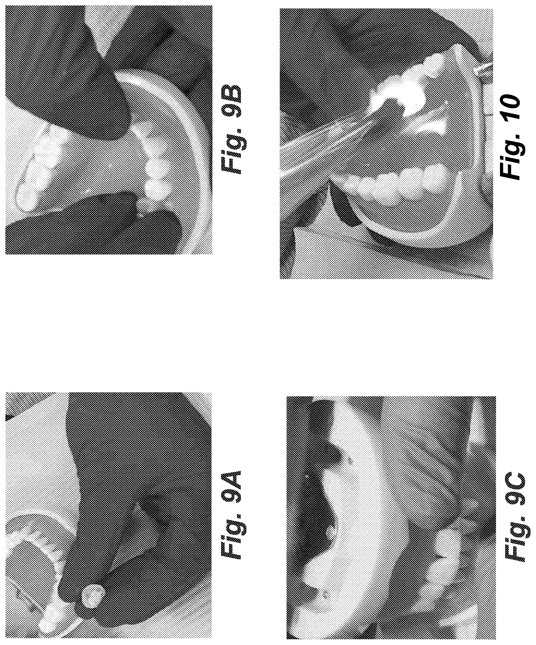 Patent US12616555 Figure 11 – Dental crown and method of use
