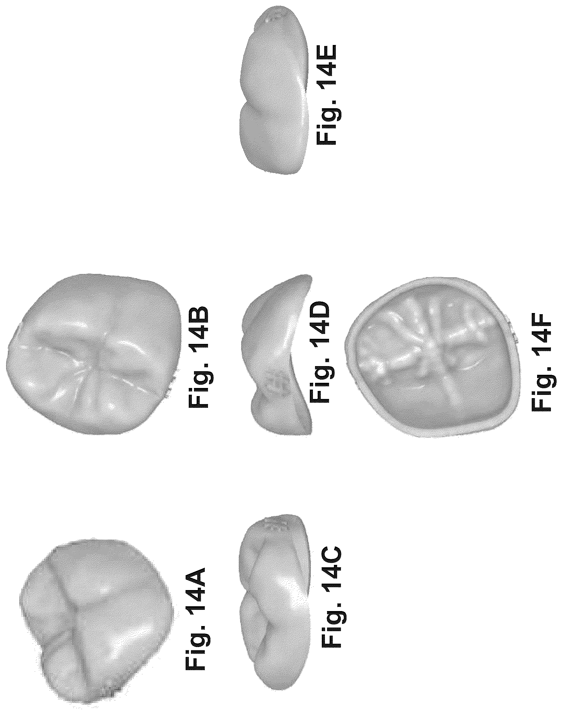 Patent US12616555 Figure 14 – Dental crown and method of use