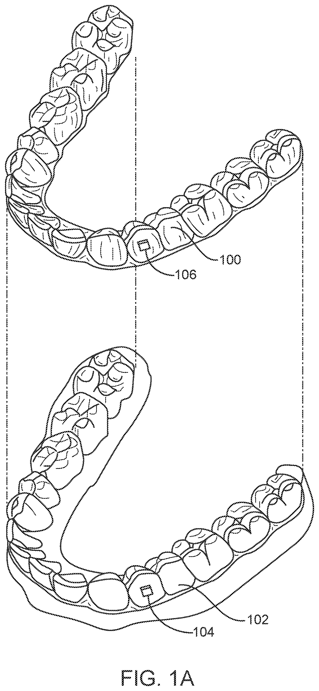 Patent US12616556 Figure 1 – Methods for direct fabrication of appliances for palate expansion