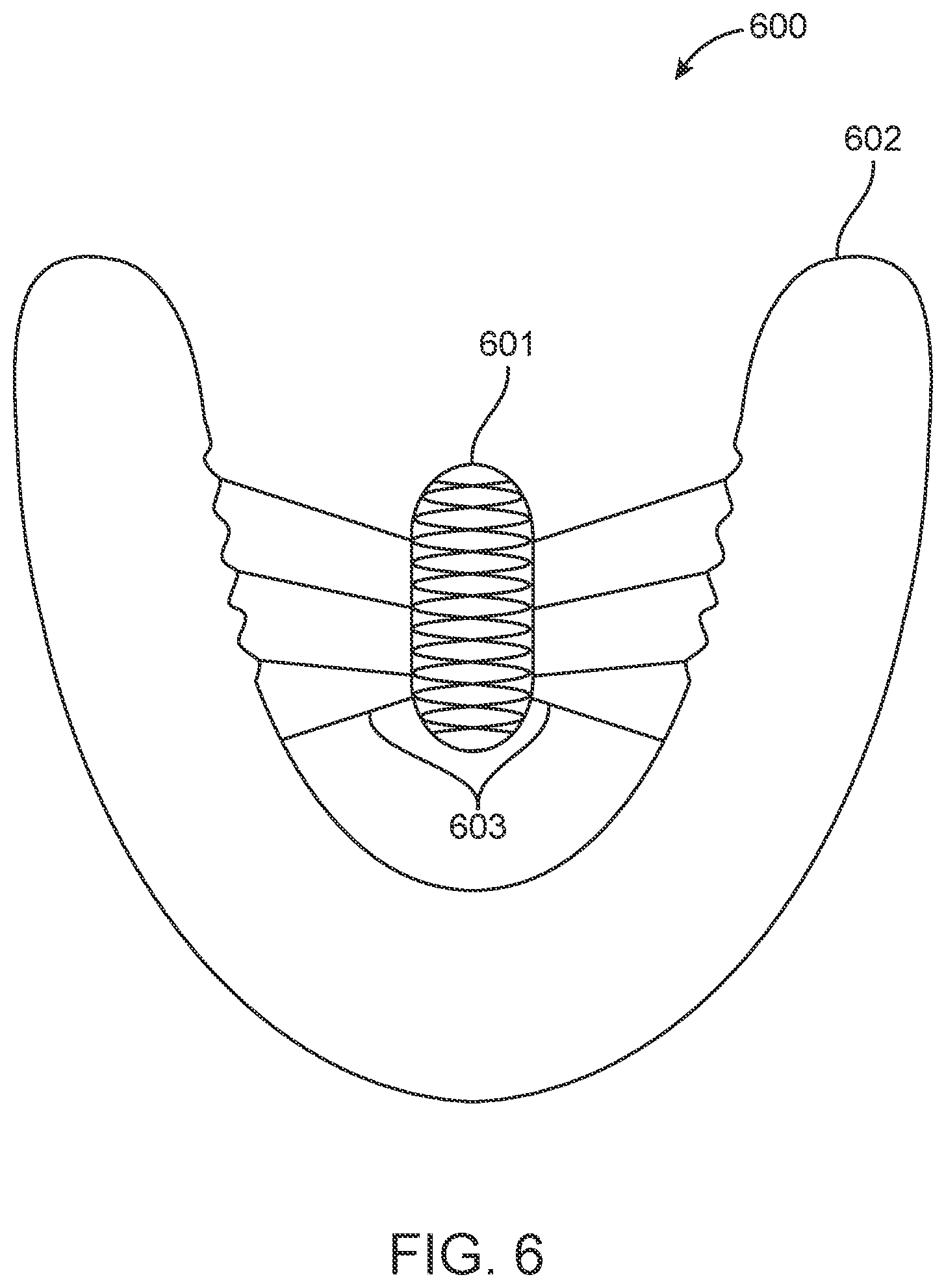 Patent US12616556 Figure 8 – Methods for direct fabrication of appliances for palate expansion