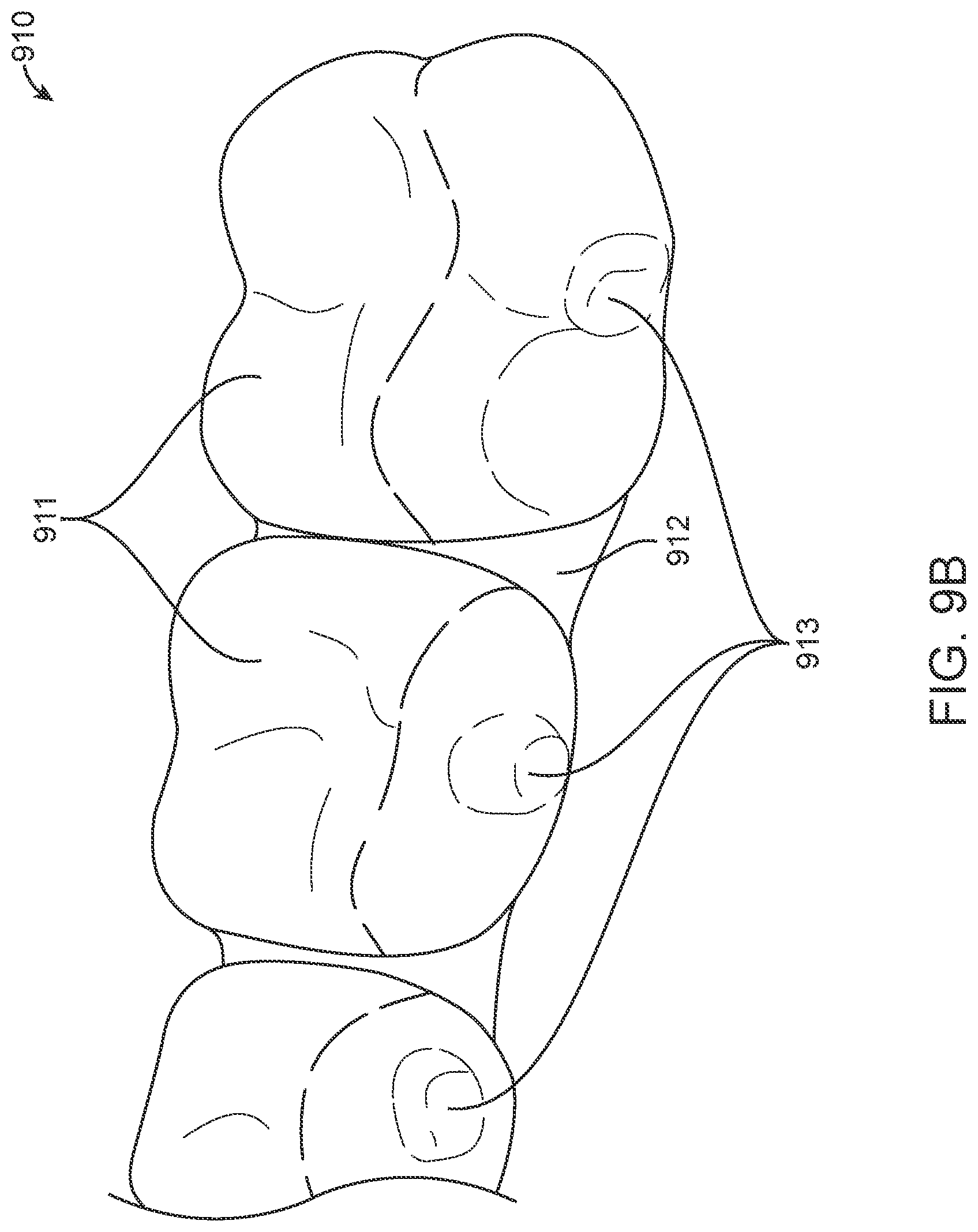 Patent US12616556 Figure 16 – Methods for direct fabrication of appliances for palate expansion