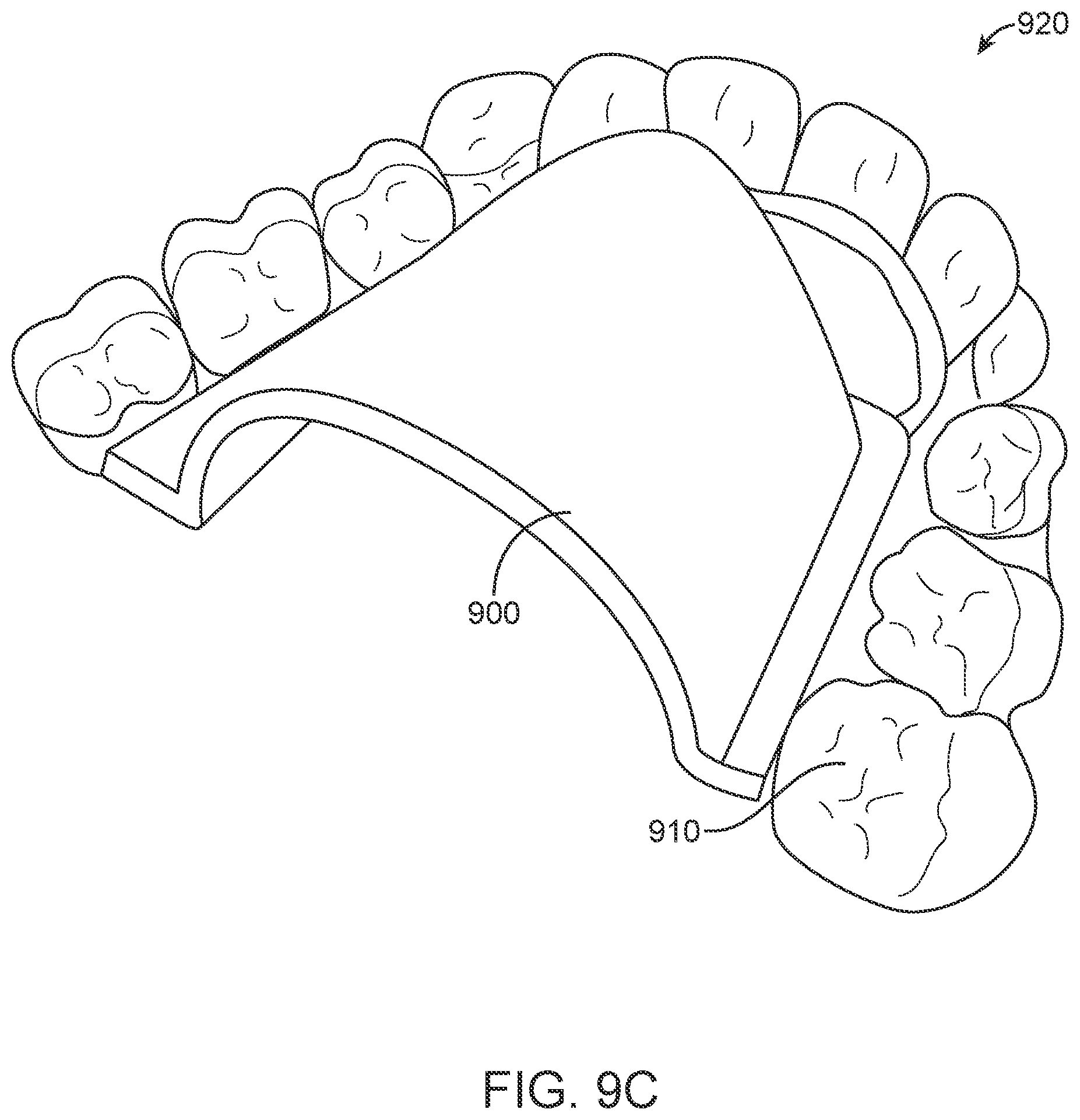 Patent US12616556 Figure 17 – Methods for direct fabrication of appliances for palate expansion
