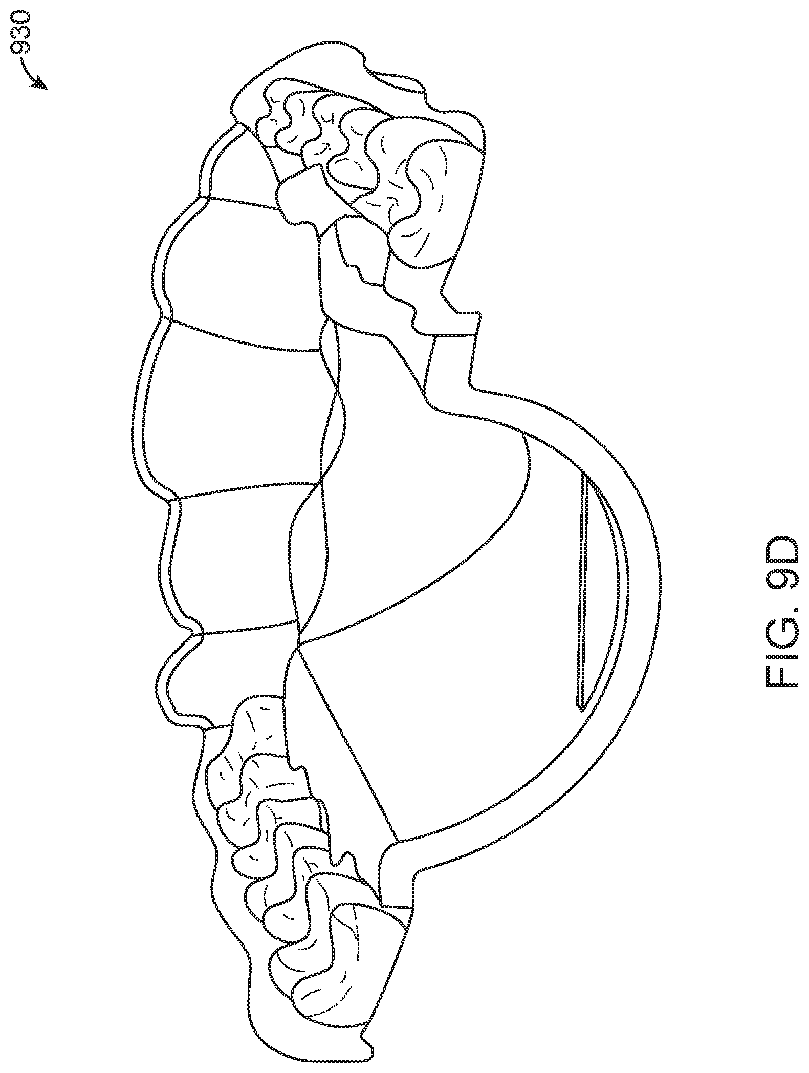 Patent US12616556 Figure 18 – Methods for direct fabrication of appliances for palate expansion