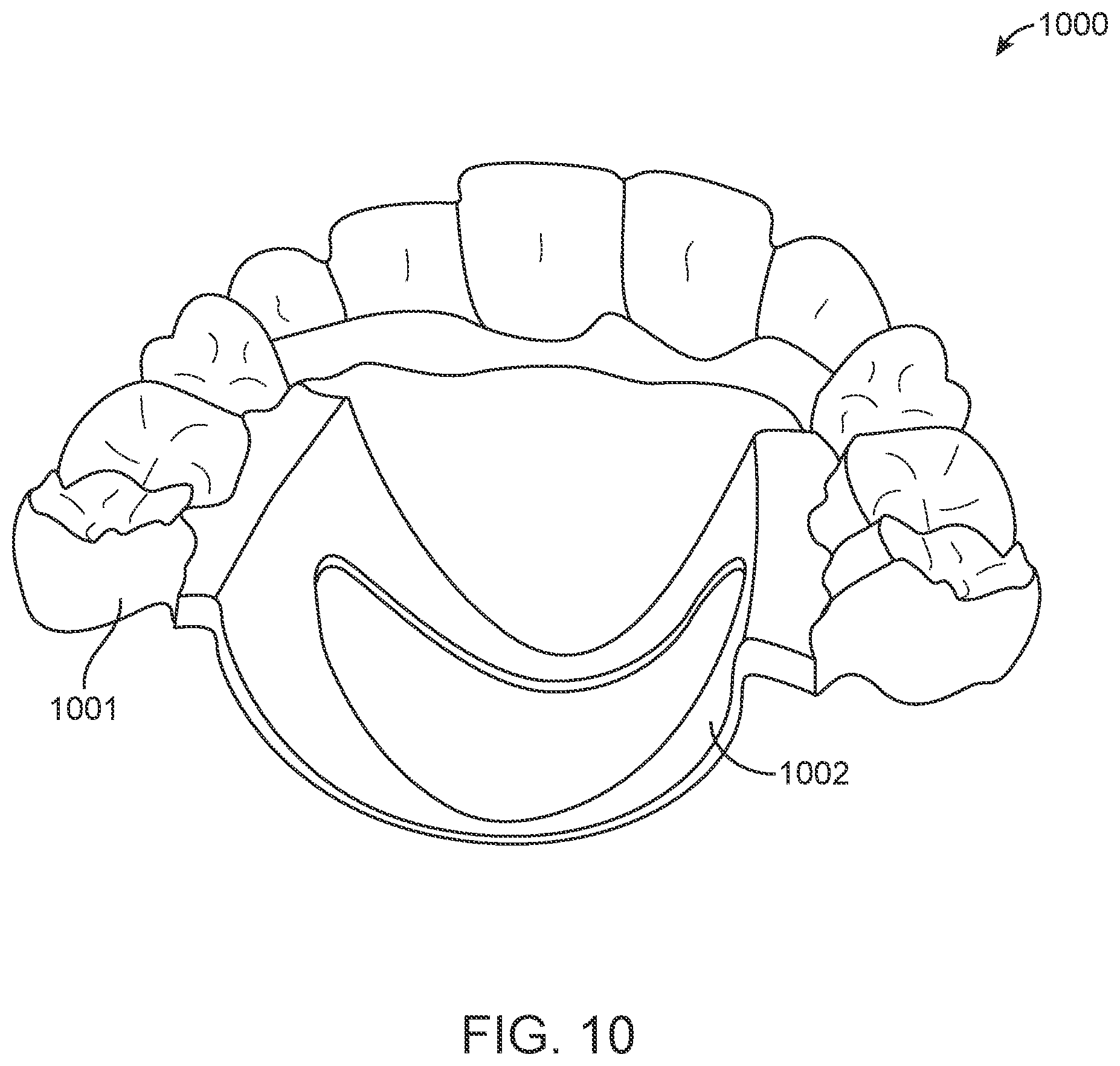 Patent US12616556 Figure 19 – Methods for direct fabrication of appliances for palate expansion