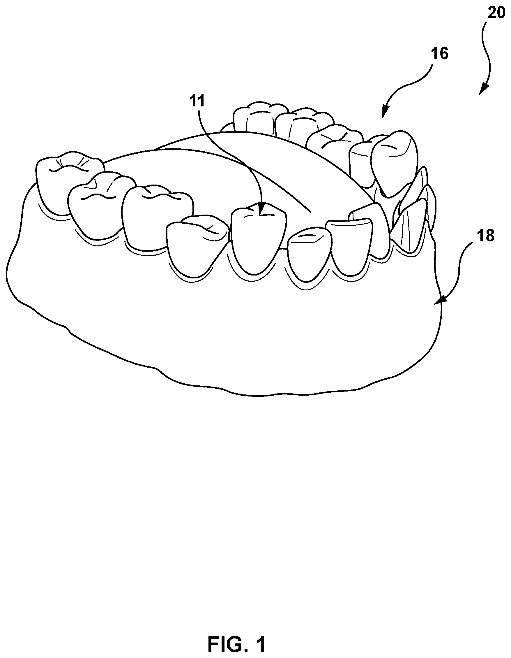 Patent US12616557 Figure 1 – Systems and methods for determining an edge of orthodontic appliances